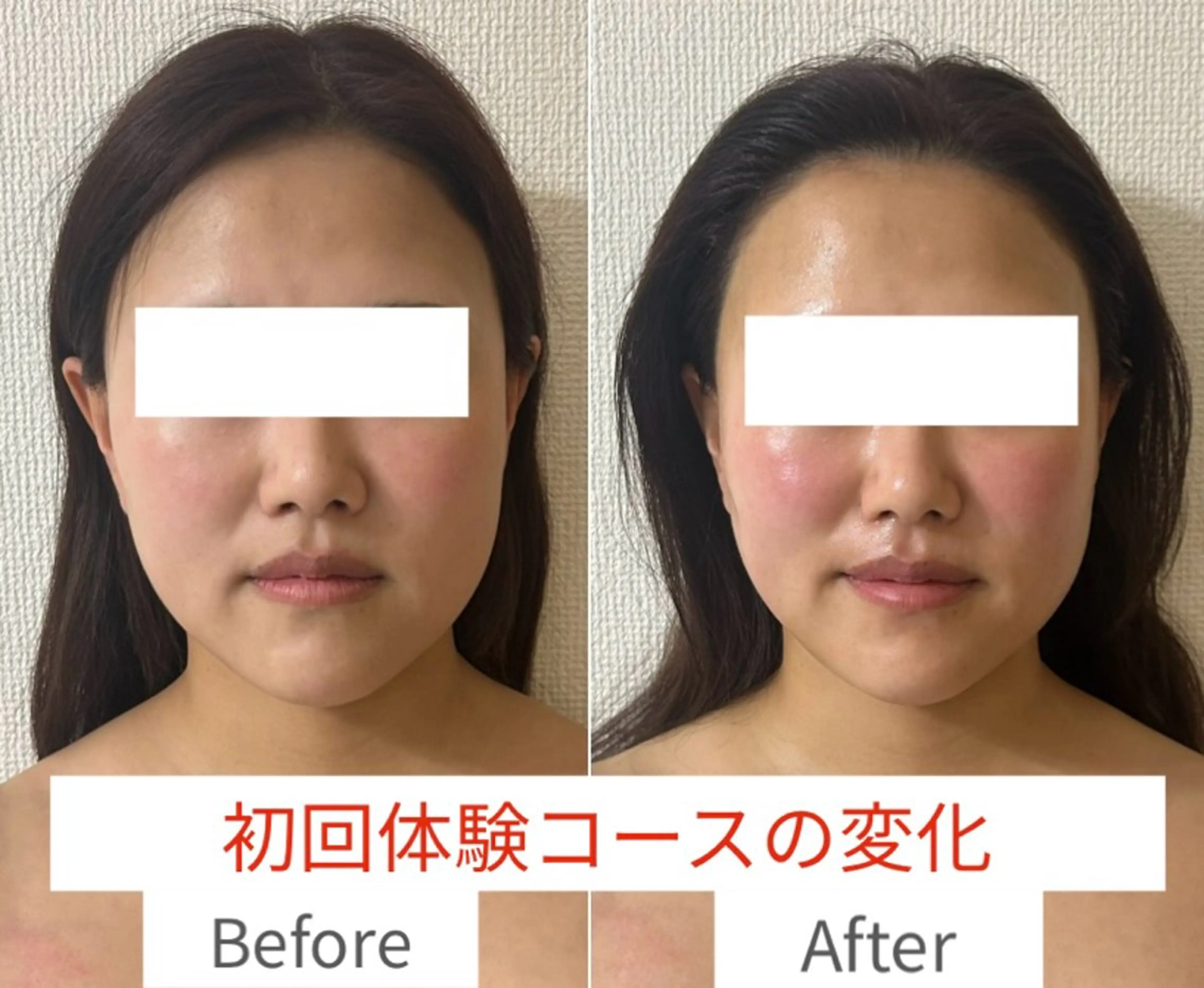 初回体験価格！　　　　　　　　　　　　　　　　　　　トライアングルフェイシャル®️の写真