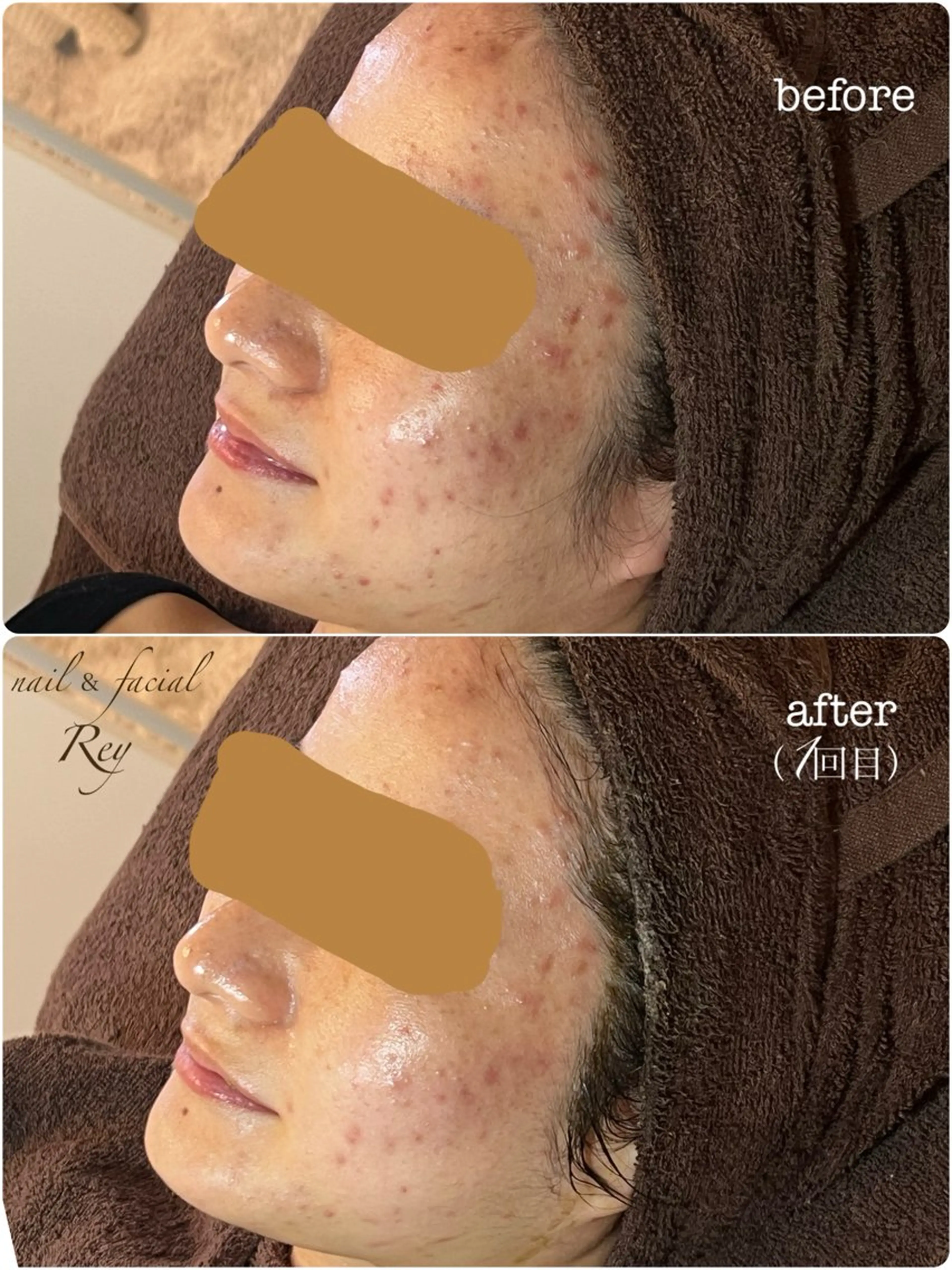 エステ R eyのネイルデザイン