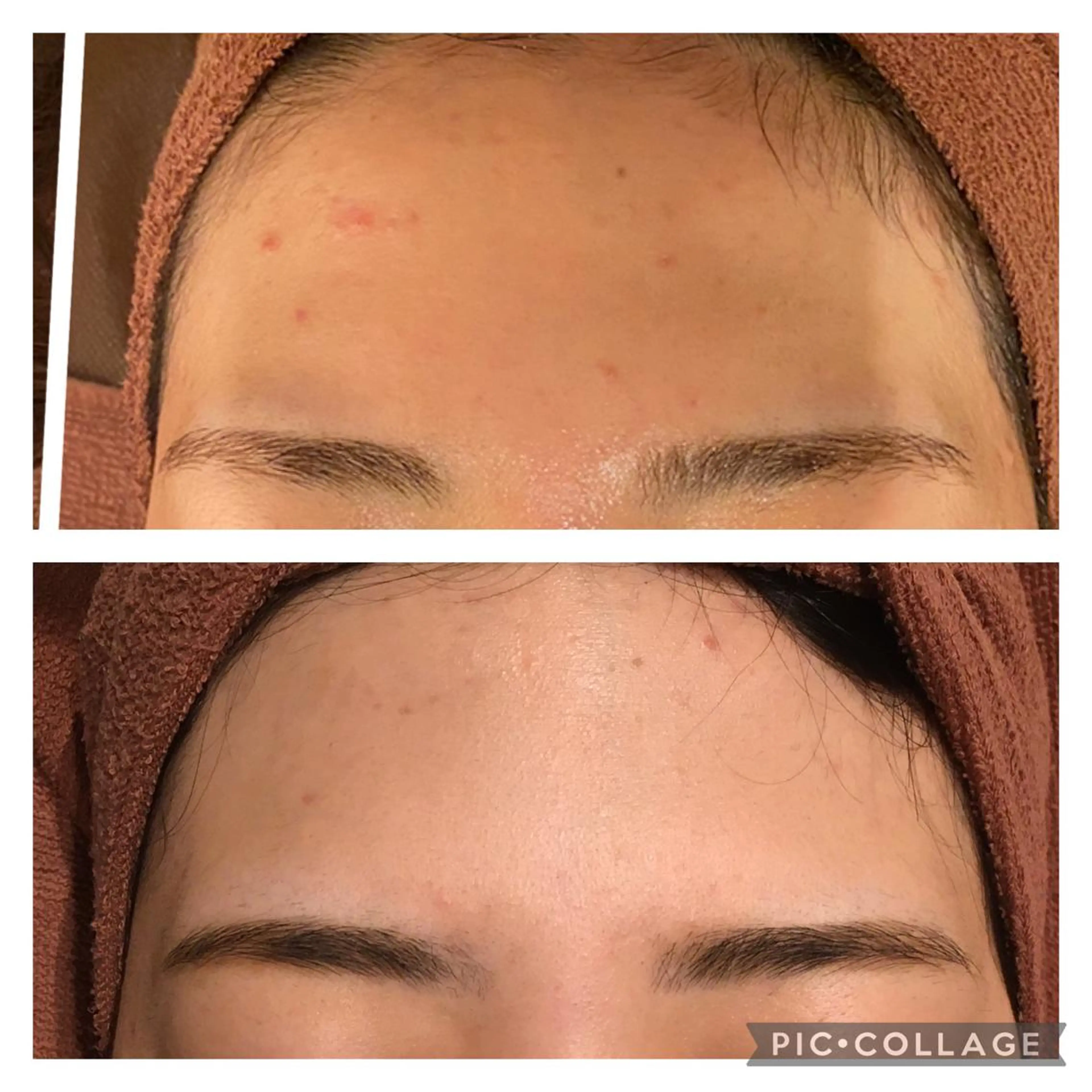 ロング カラー パーマ ヘアアレンジ メンズ キッズ ネイル マツエク・マツパ アイブロウ エステ リラク ニキビ特化型エステ 🍋最短で肌質改善のエステ・リラクイメージ