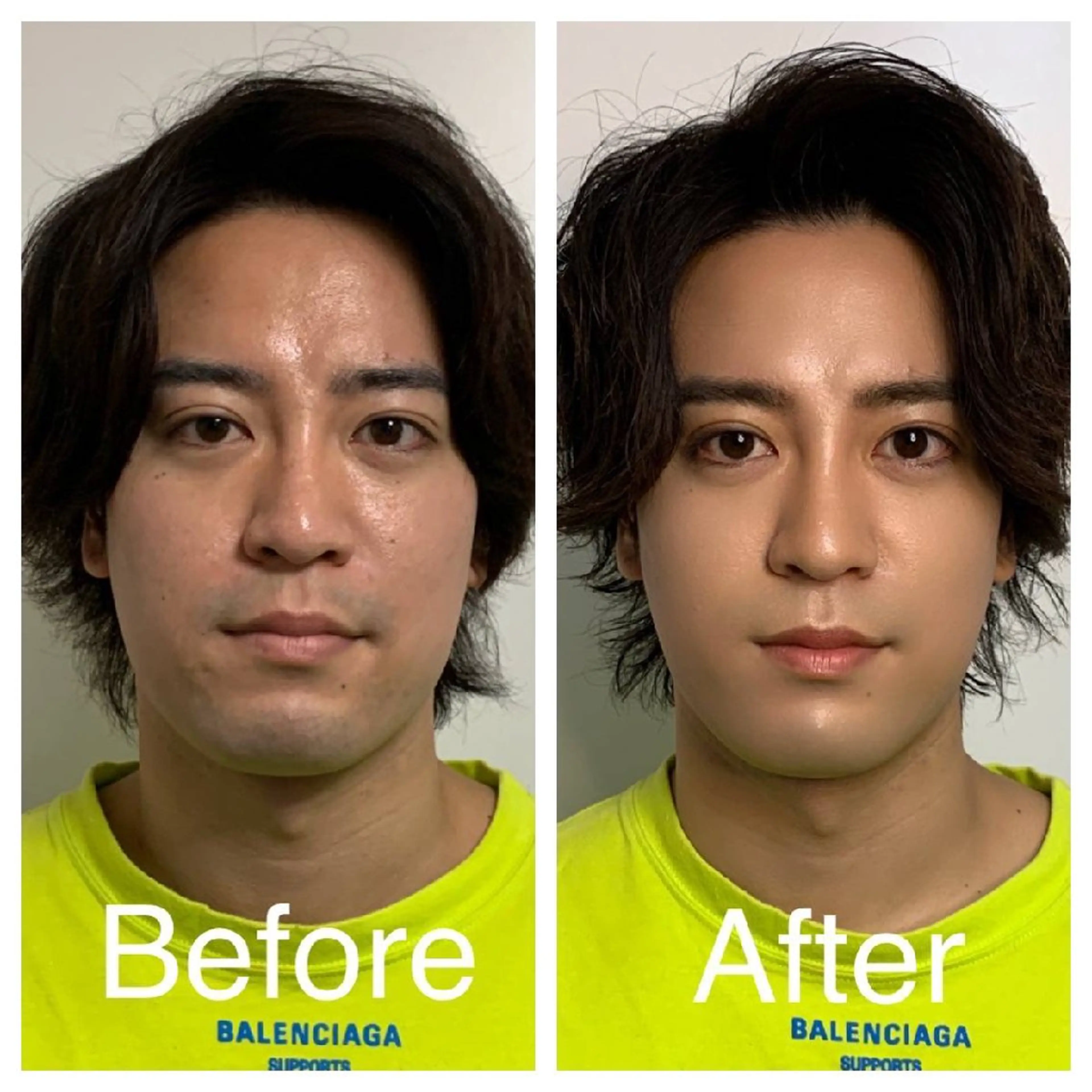 メンズ La Luna所属・医療提携サロン新宿 La Lunaのエステ・リラクイメージ