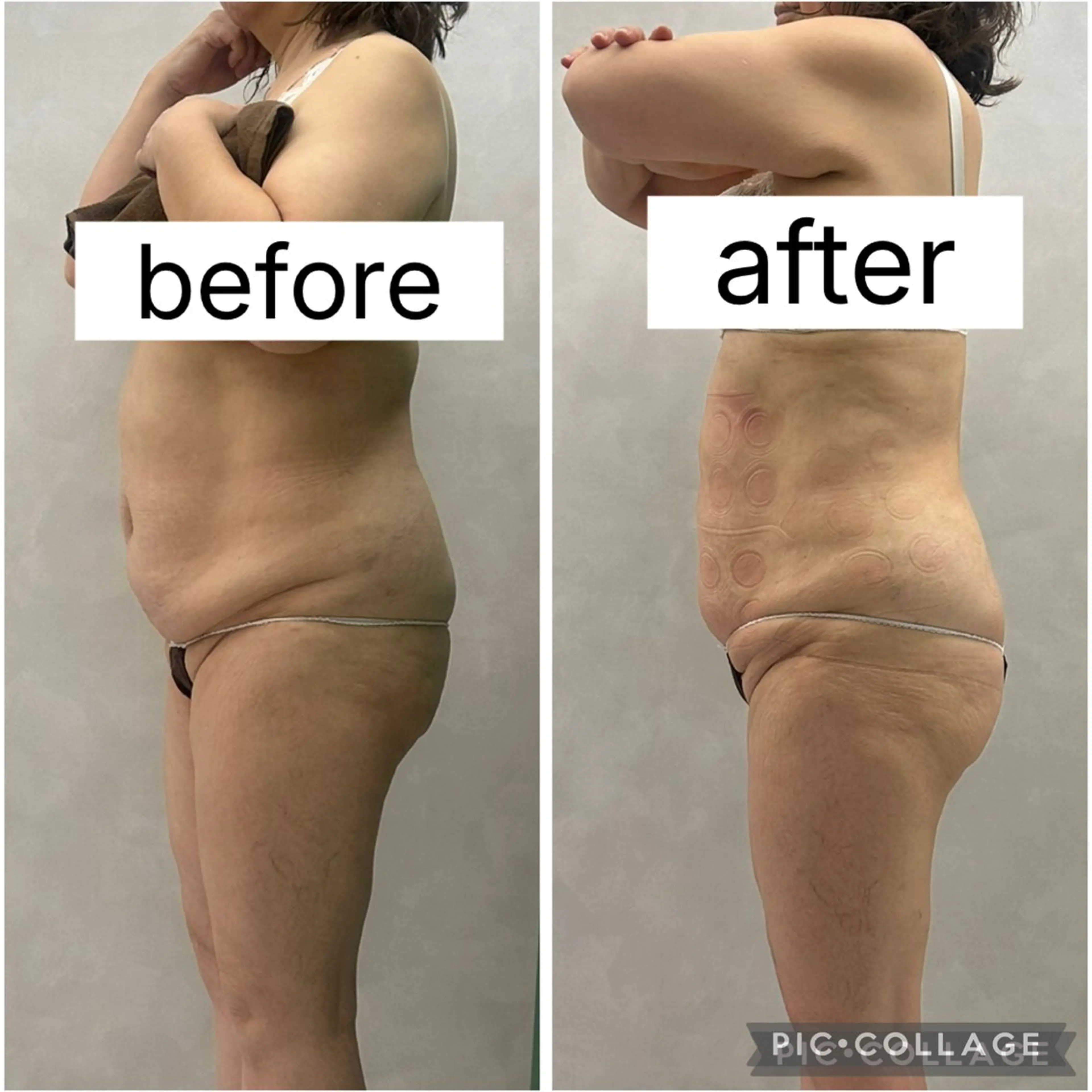 エステ 痩身専門エステサロン Eclatのエステ・リラクイメージ