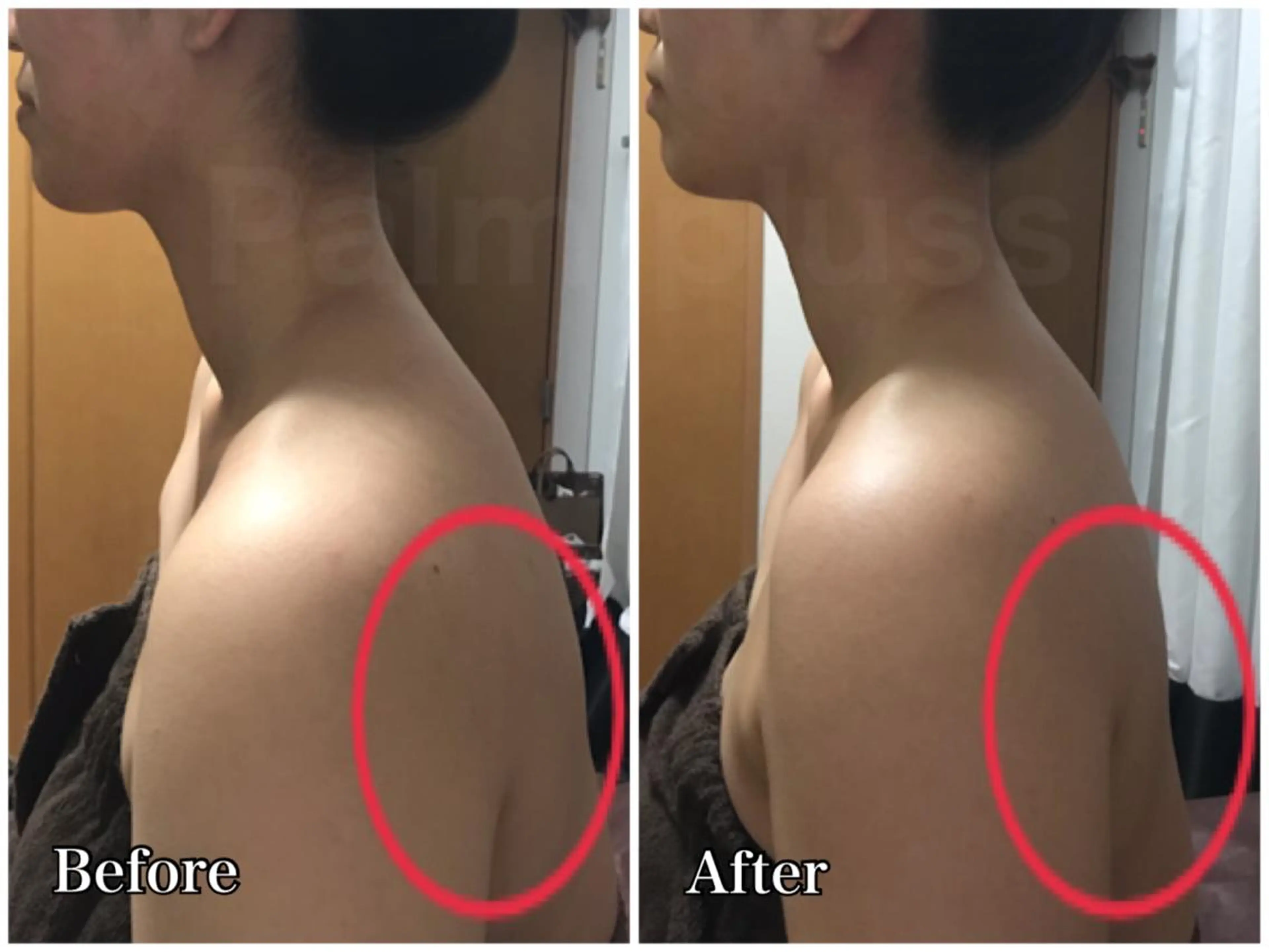 首肩こり専門サロン Kalnicco/カルニッコ所属・Kalnicco (カルニッコ)のエステ・リラクイメージ