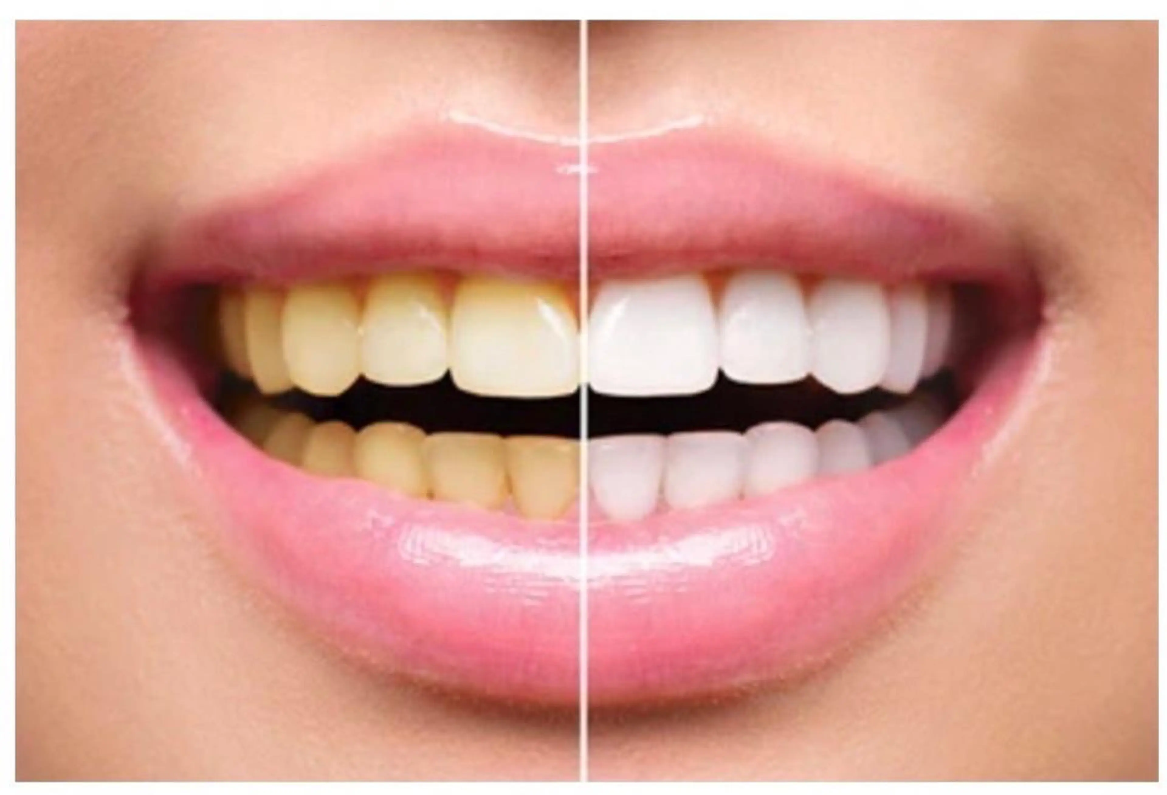 ベルーテ エッセンスのエステ・リラクイメージ