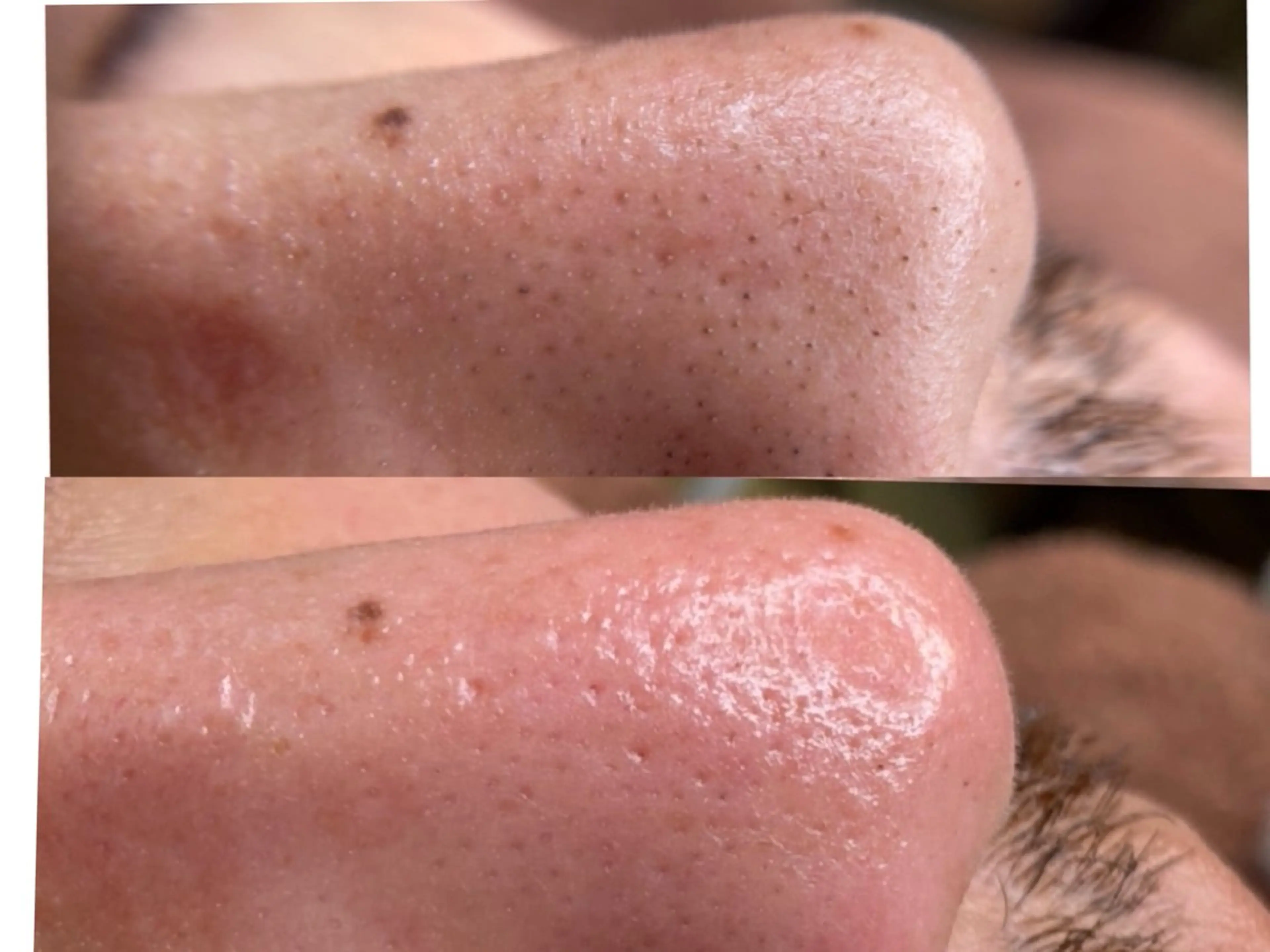 韓国式３D毛穴洗浄＆ 脱毛vive京橋のエステ・リラクイメージ