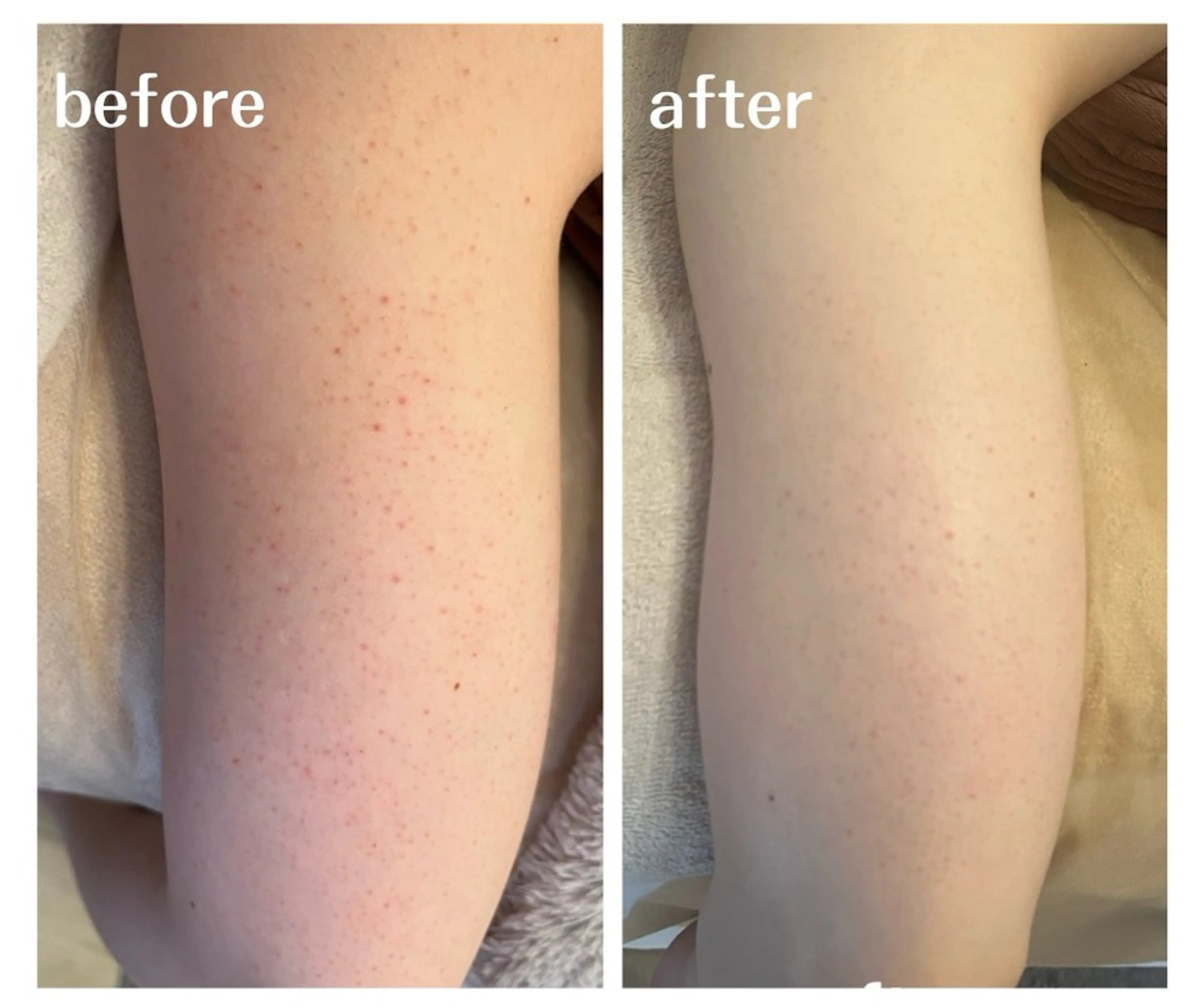 エステ aimee　肌質改善サロン【アイミー】所属・肌質改善サロン aimee｜アイミーのエステ・リラクイメージ