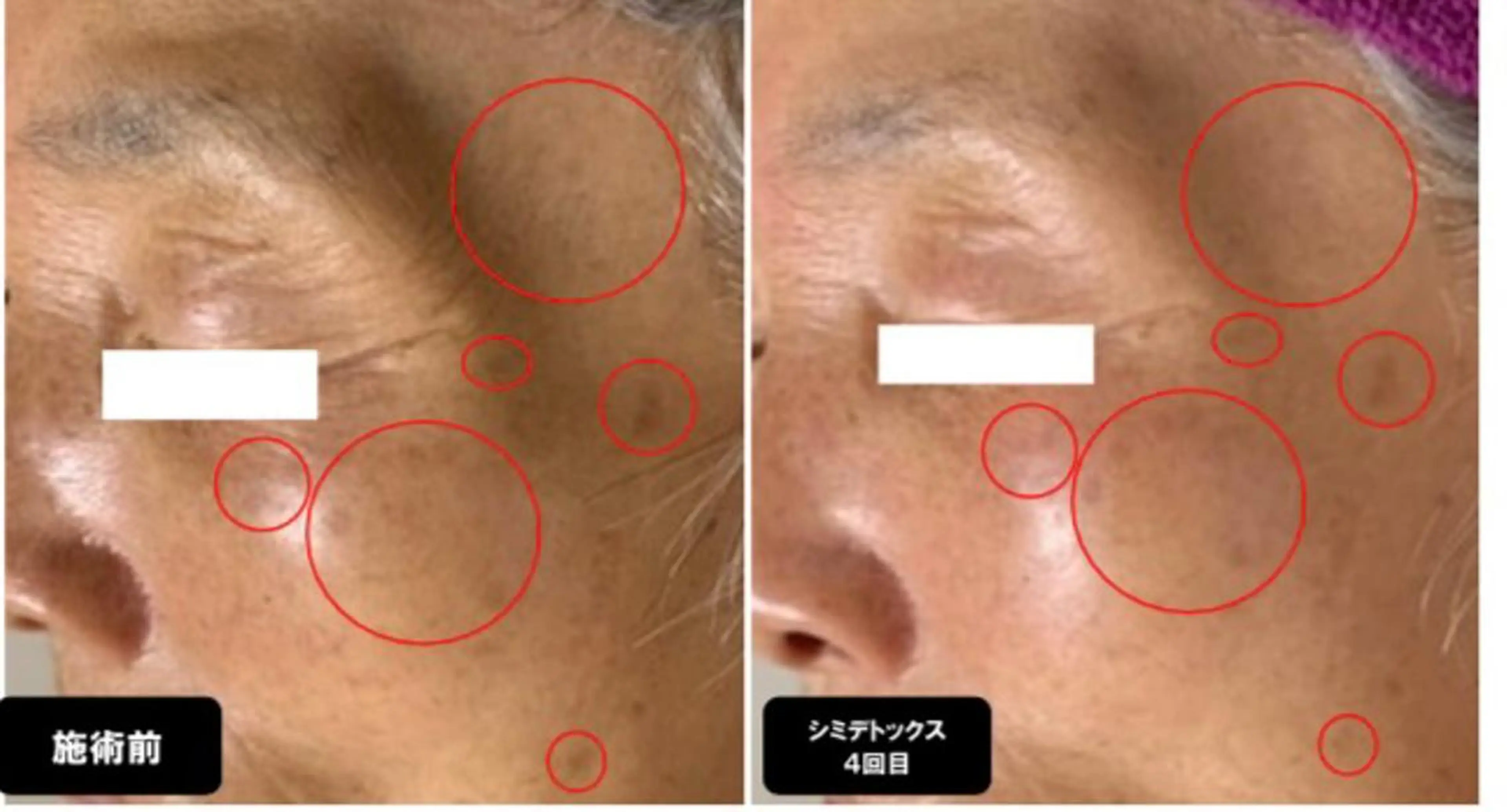 エステ ヴィーナス ビューティーのエステ・リラクイメージ