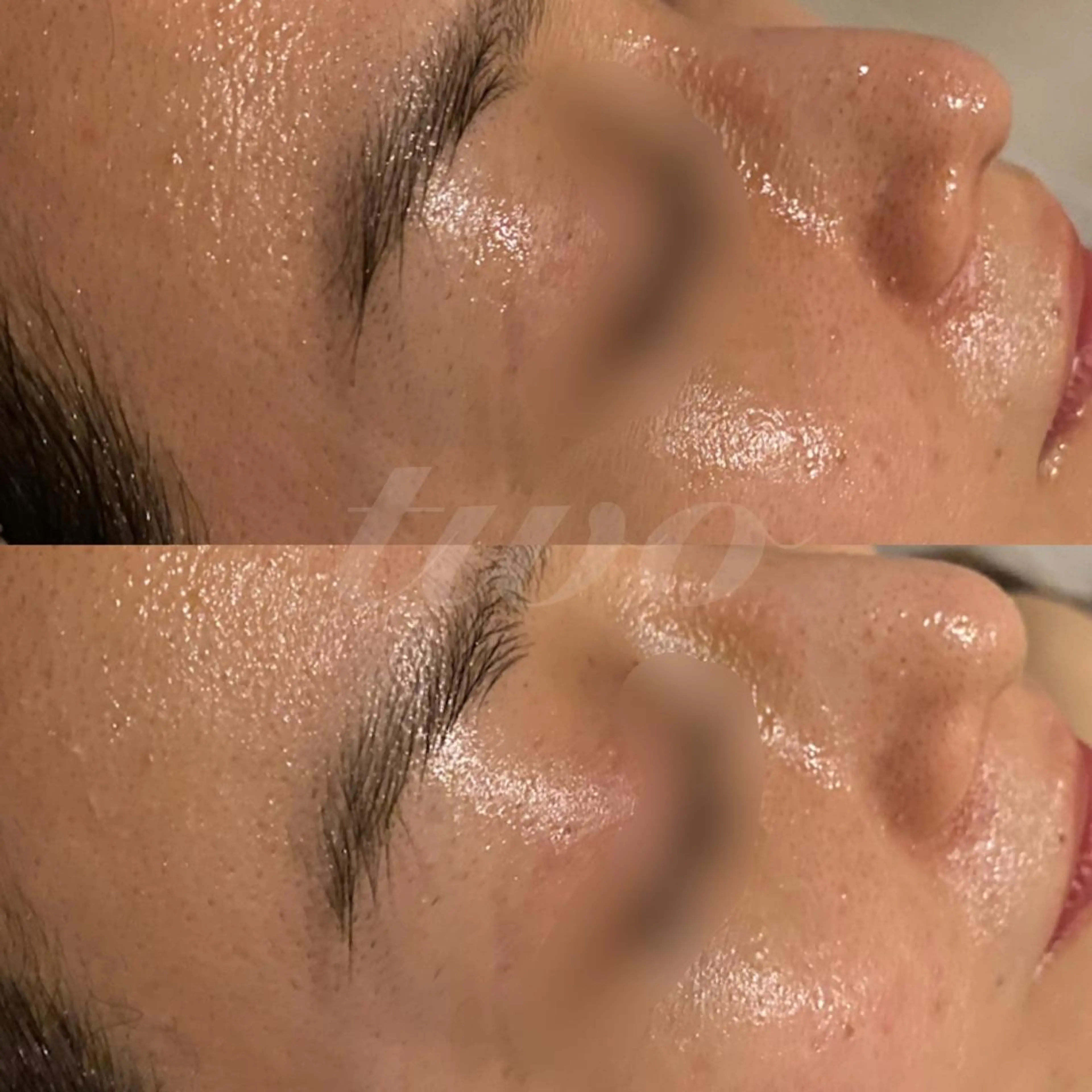 エステ 《心斎橋》 twoのエステ・リラクイメージ