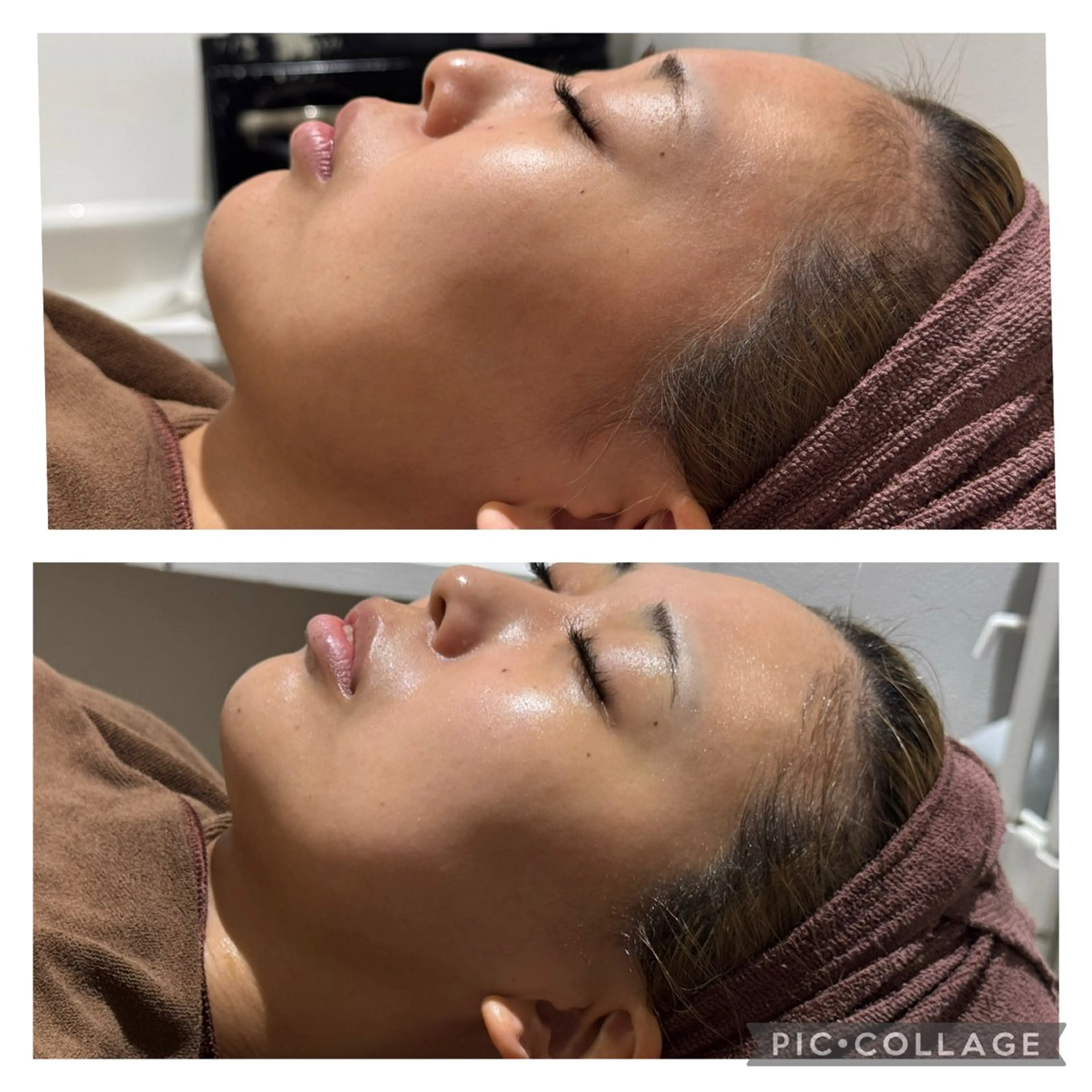 ニキビケア専門サロン Unityのエステ・リラクイメージ