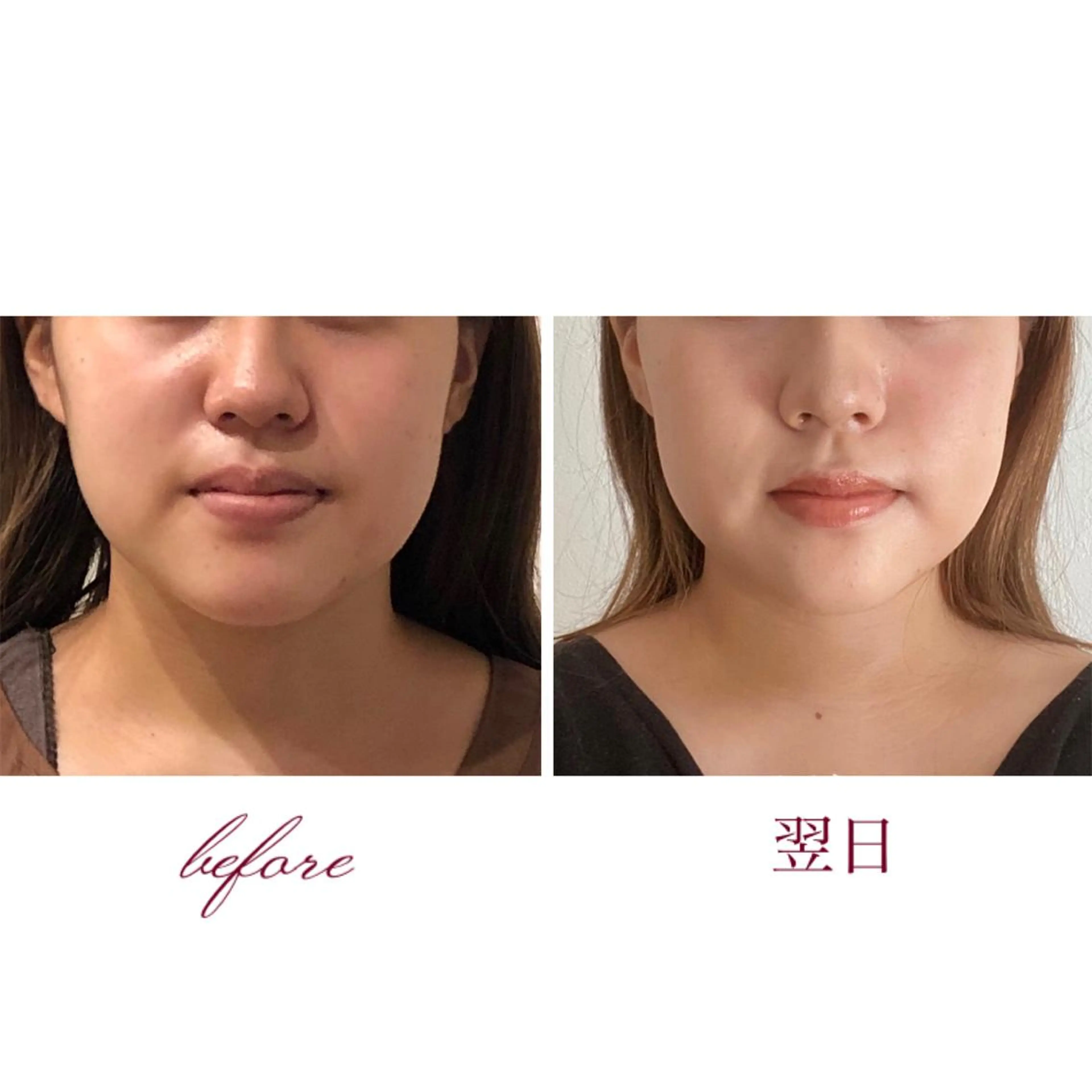 《💎ご褒美コース》自律神経を整えてストレスも解消✨小顔矯正＋頭蓋骨調整ヘッドスパ＋究極の体疲れケア（80分）の写真