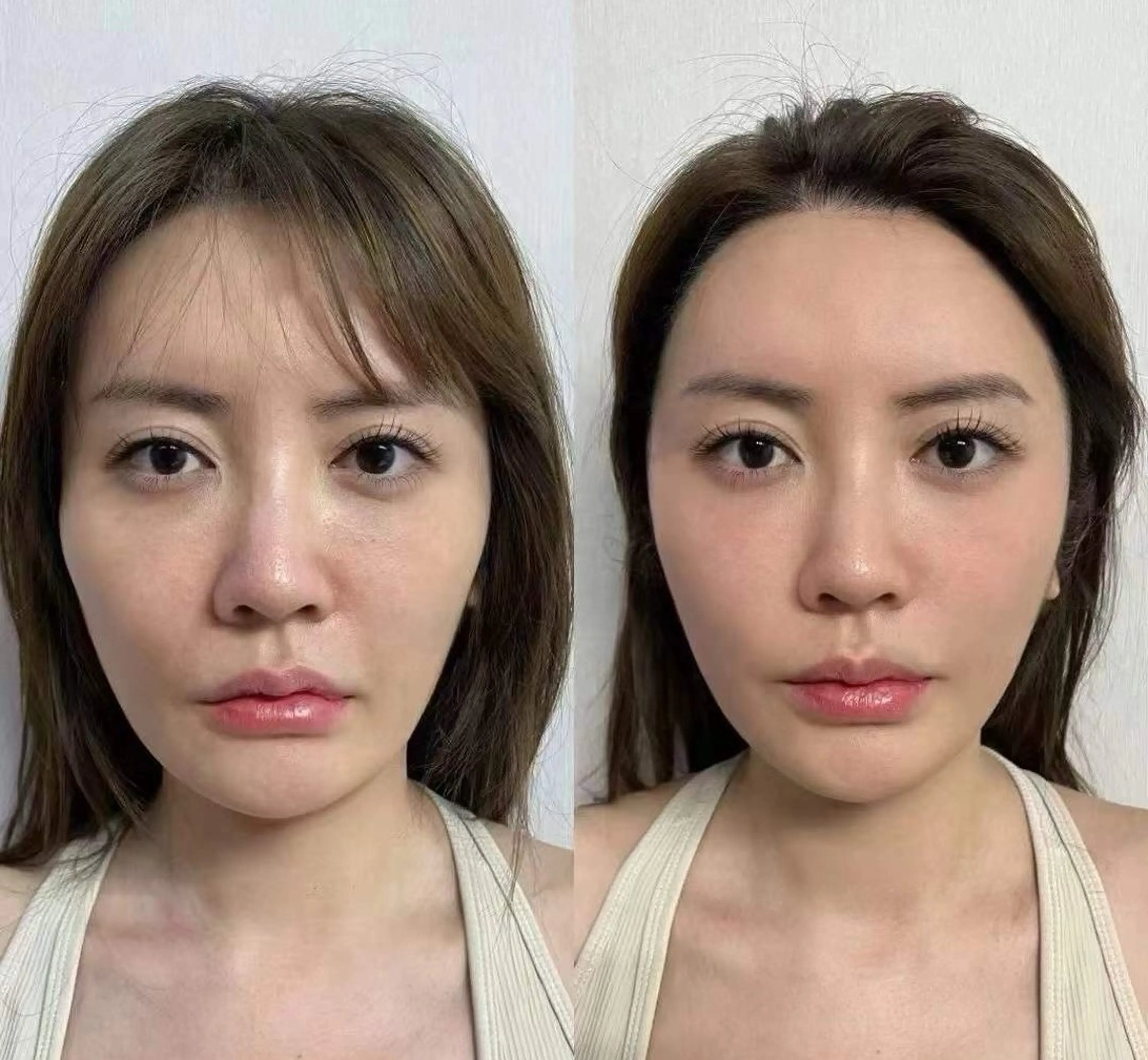 ネイル エステ aliaハイフ&水光ジェットサロン所属・aliaハーブ水光店 エステティシャン募集のエステ・リラクイメージ