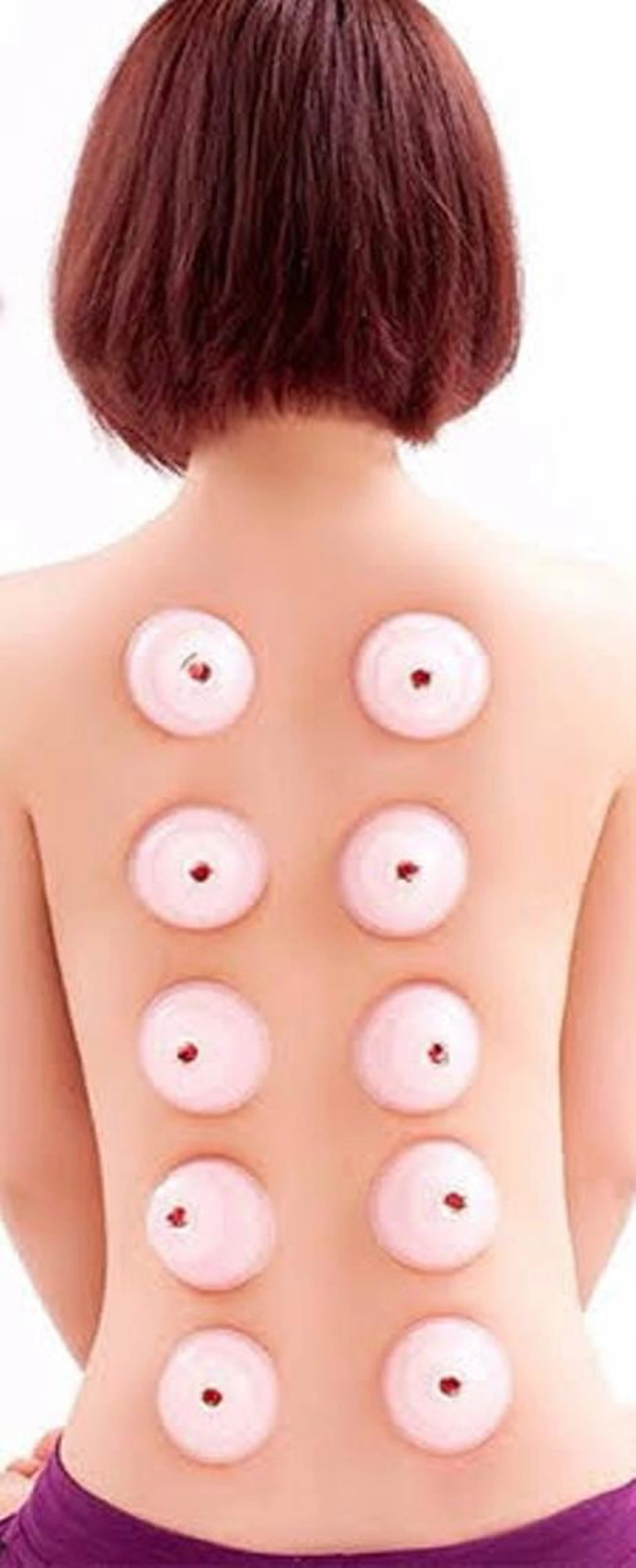 首肩凝りを撃退!クセになるカッピングの写真
