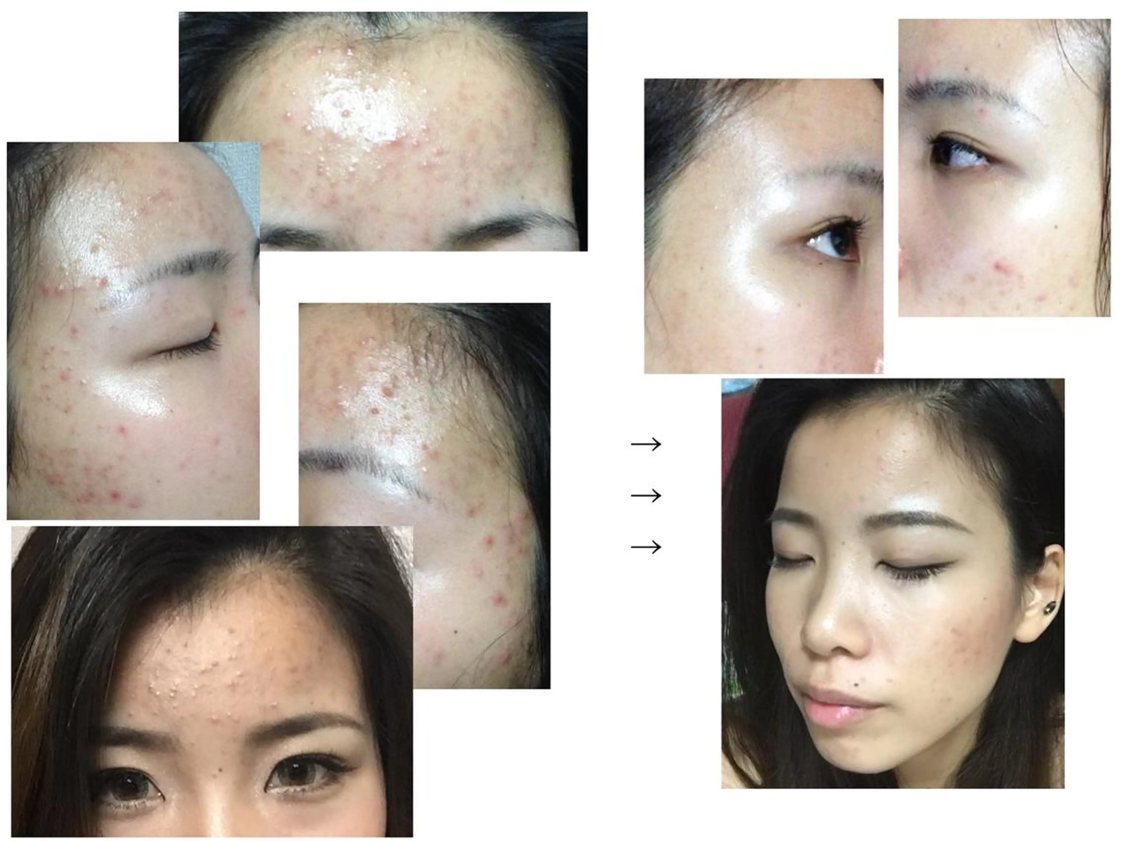 tominaga ryokoのヘアスタイル