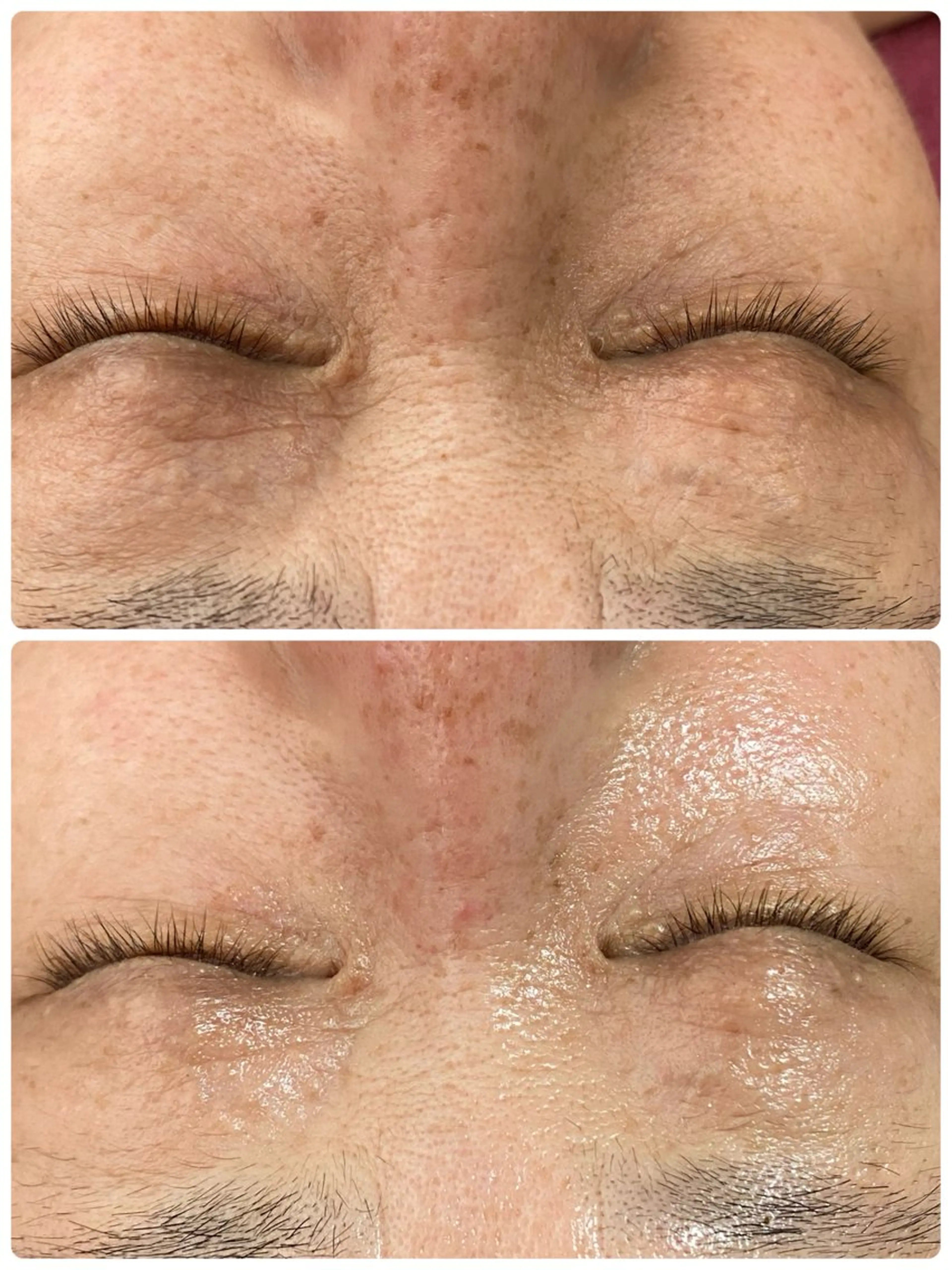 エステ REVI取扱・肌悩み 毛穴Chalonのエステ・リラクイメージ