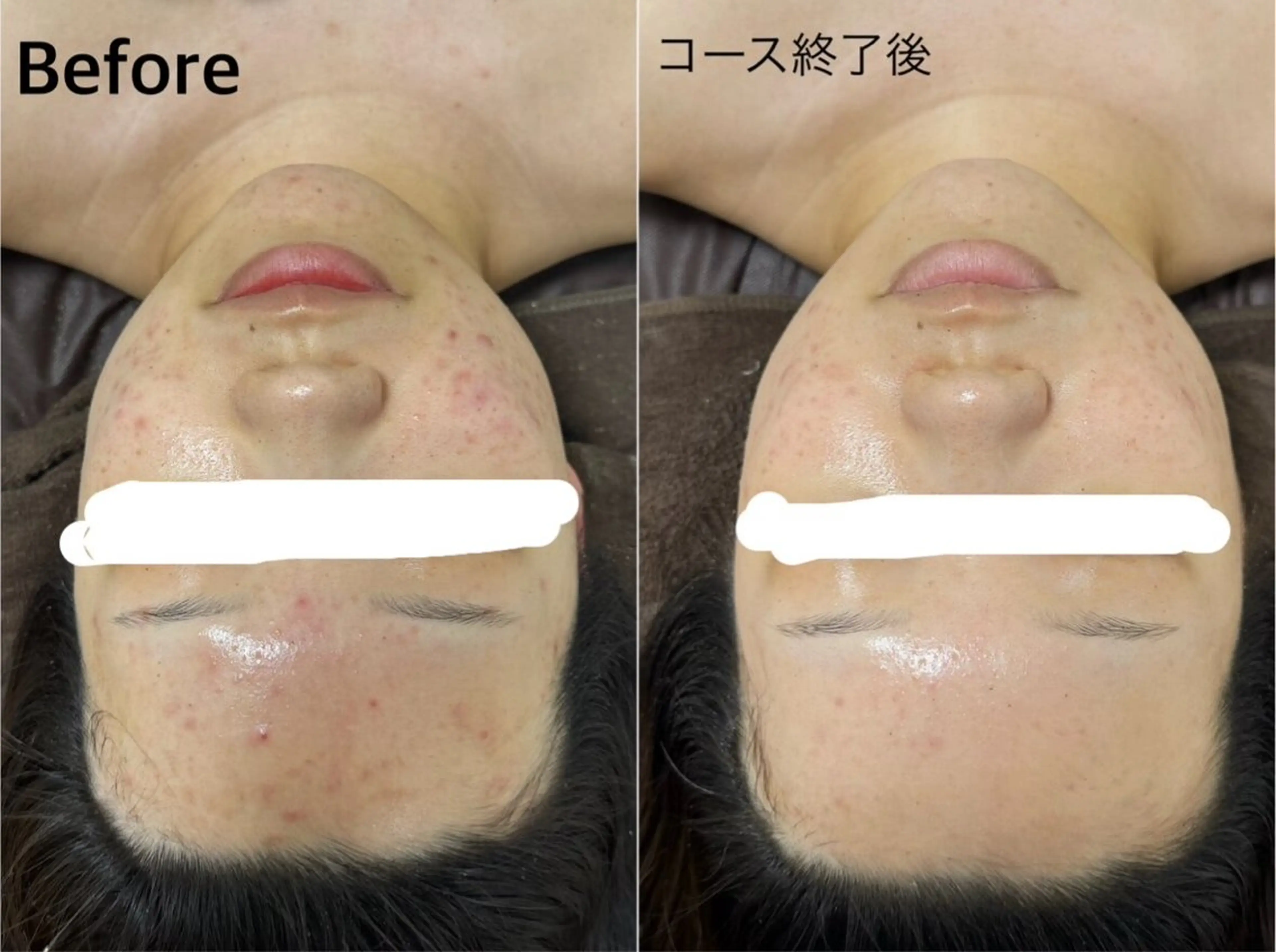 ビューティーサロン ア・クイーユのエステ・リラクイメージ