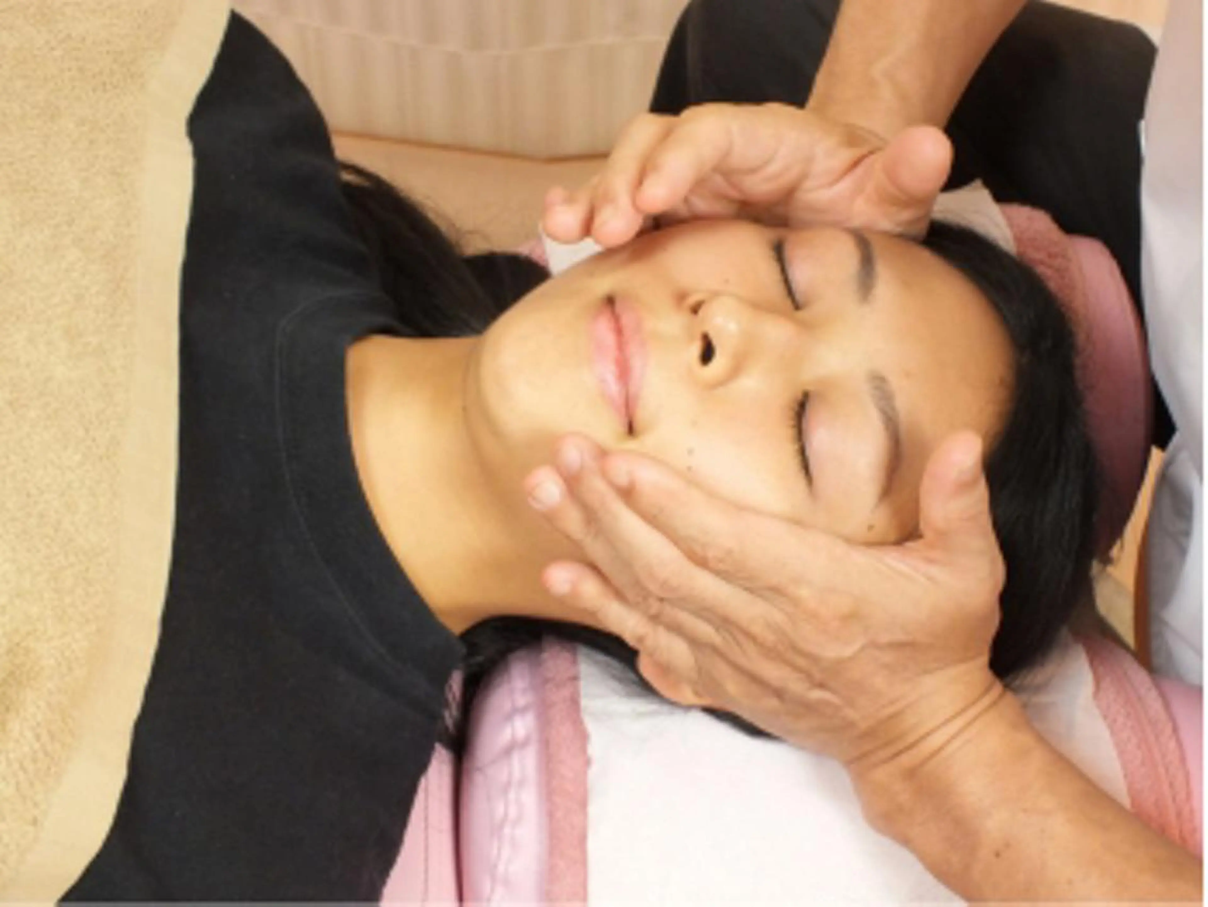 小顔調整の写真