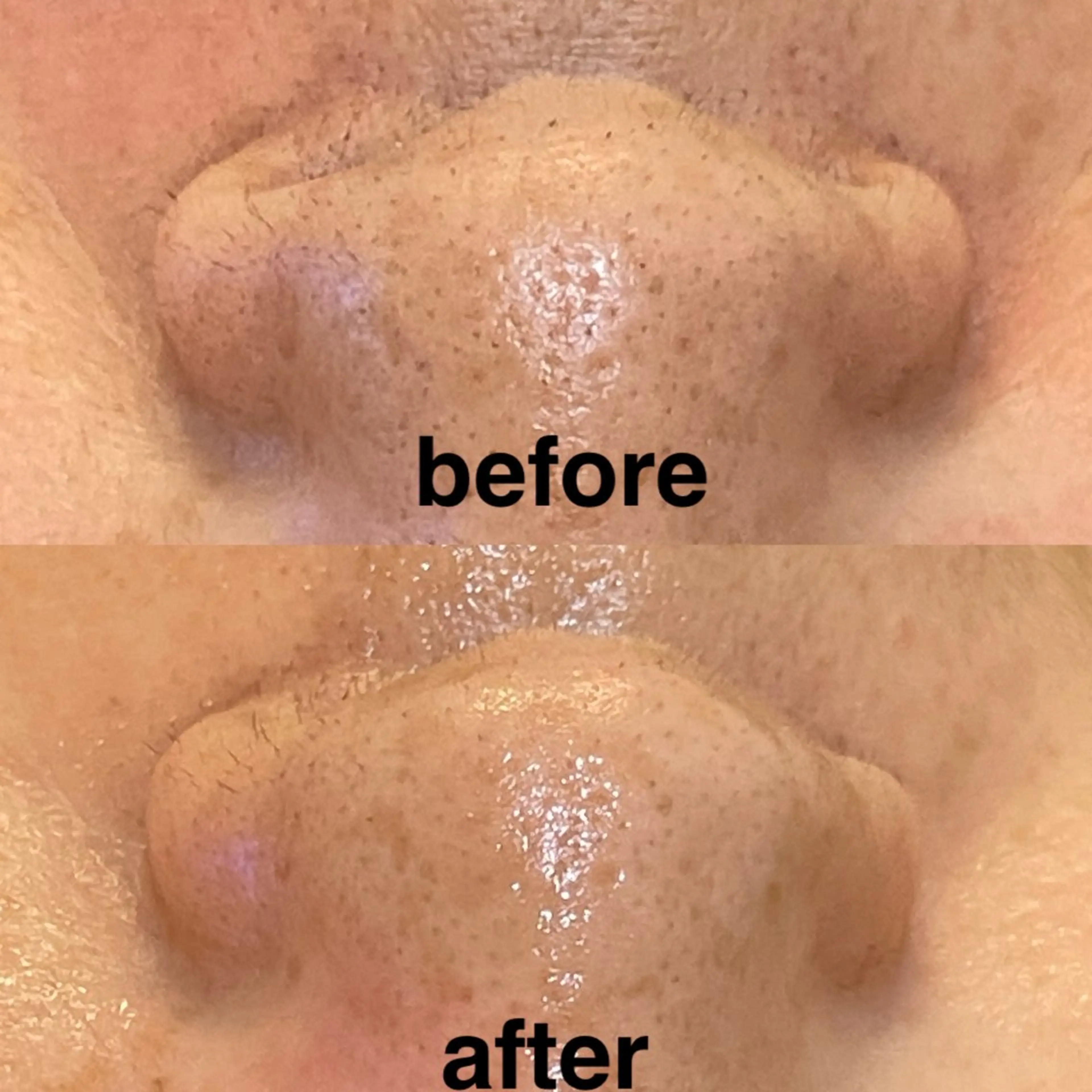 メンズ 🔥メンズ特化🔥 兵藤　太樹の眉毛・アイブロウイメージ