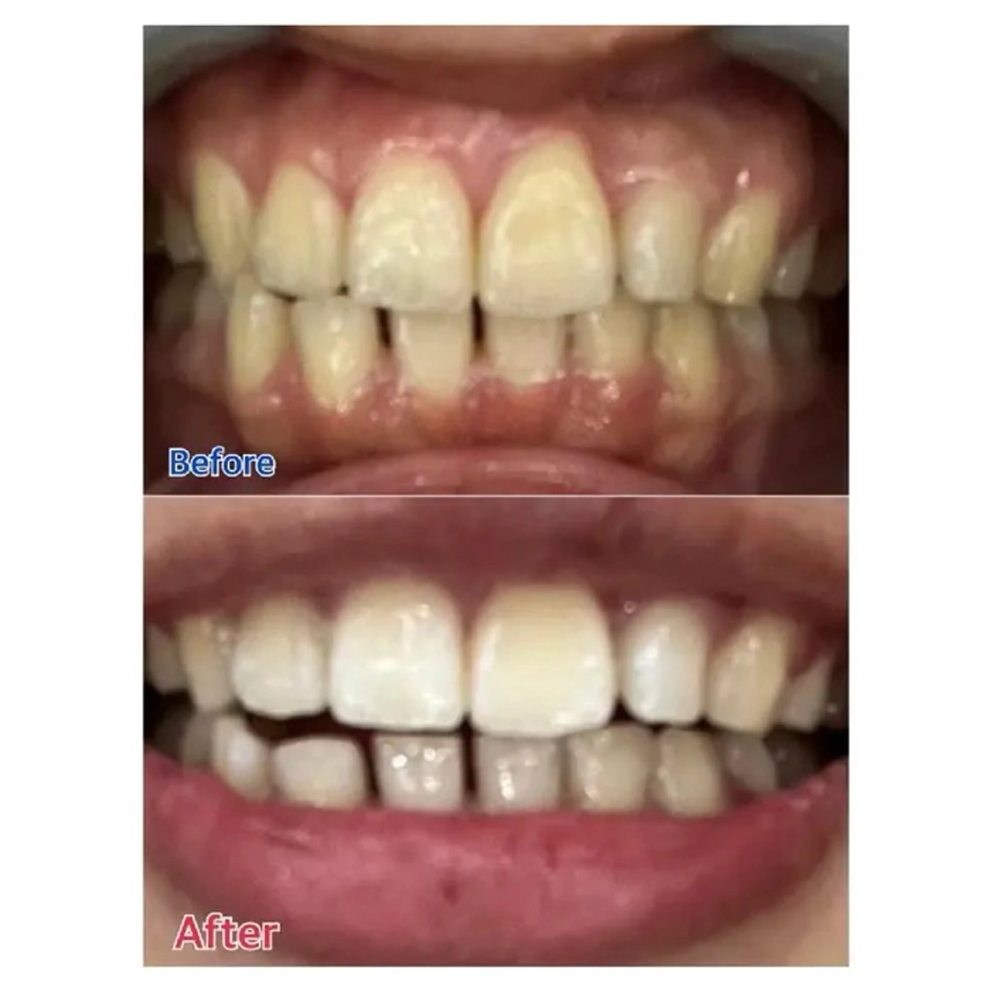 M渋谷 ホワイトニングのエステ・リラクイメージ