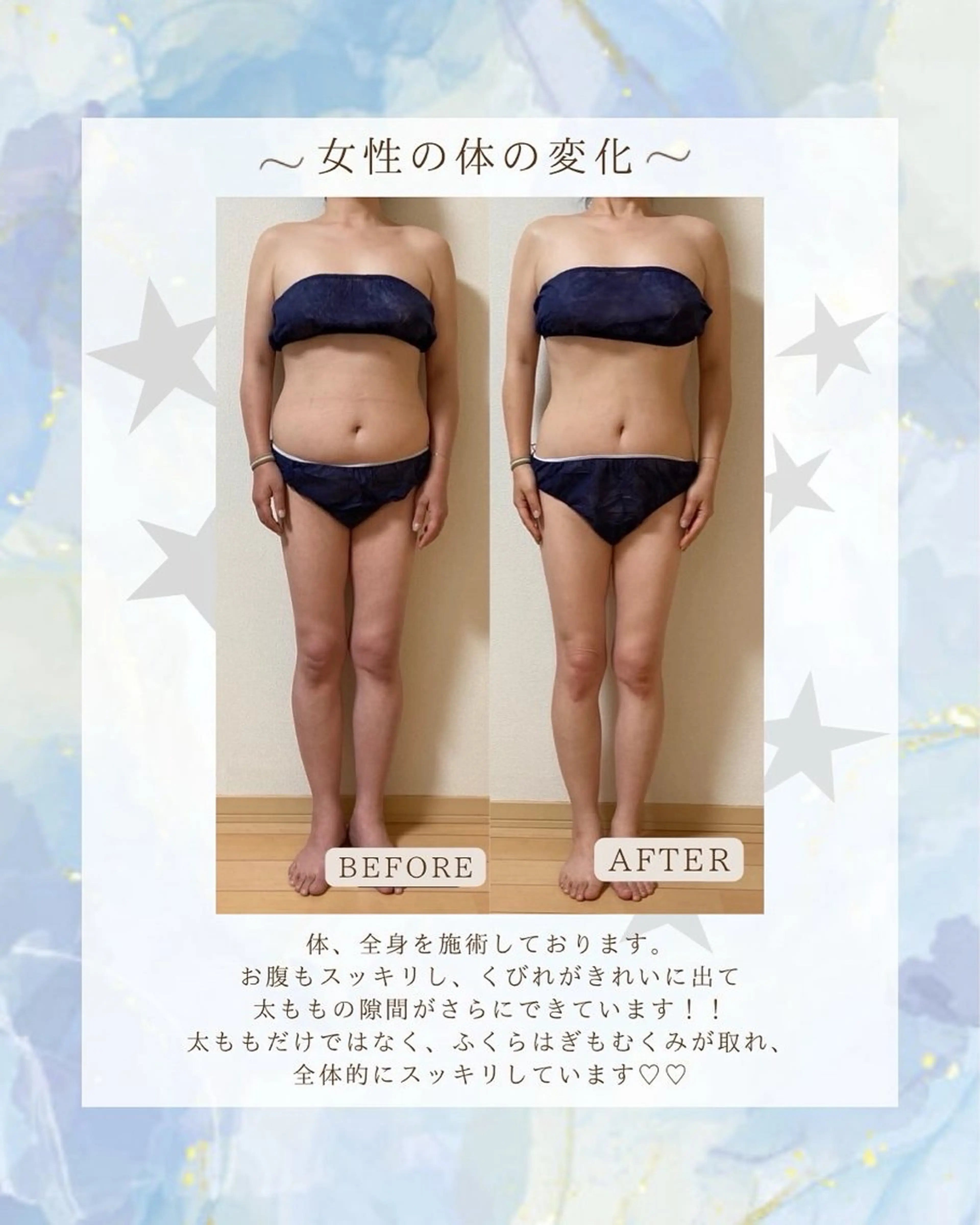 【ヒップアップ&脚のむくみケア】お尻が弛んできた、脚のむくみや冷えが気になる方におすすめです🌼🤍の写真