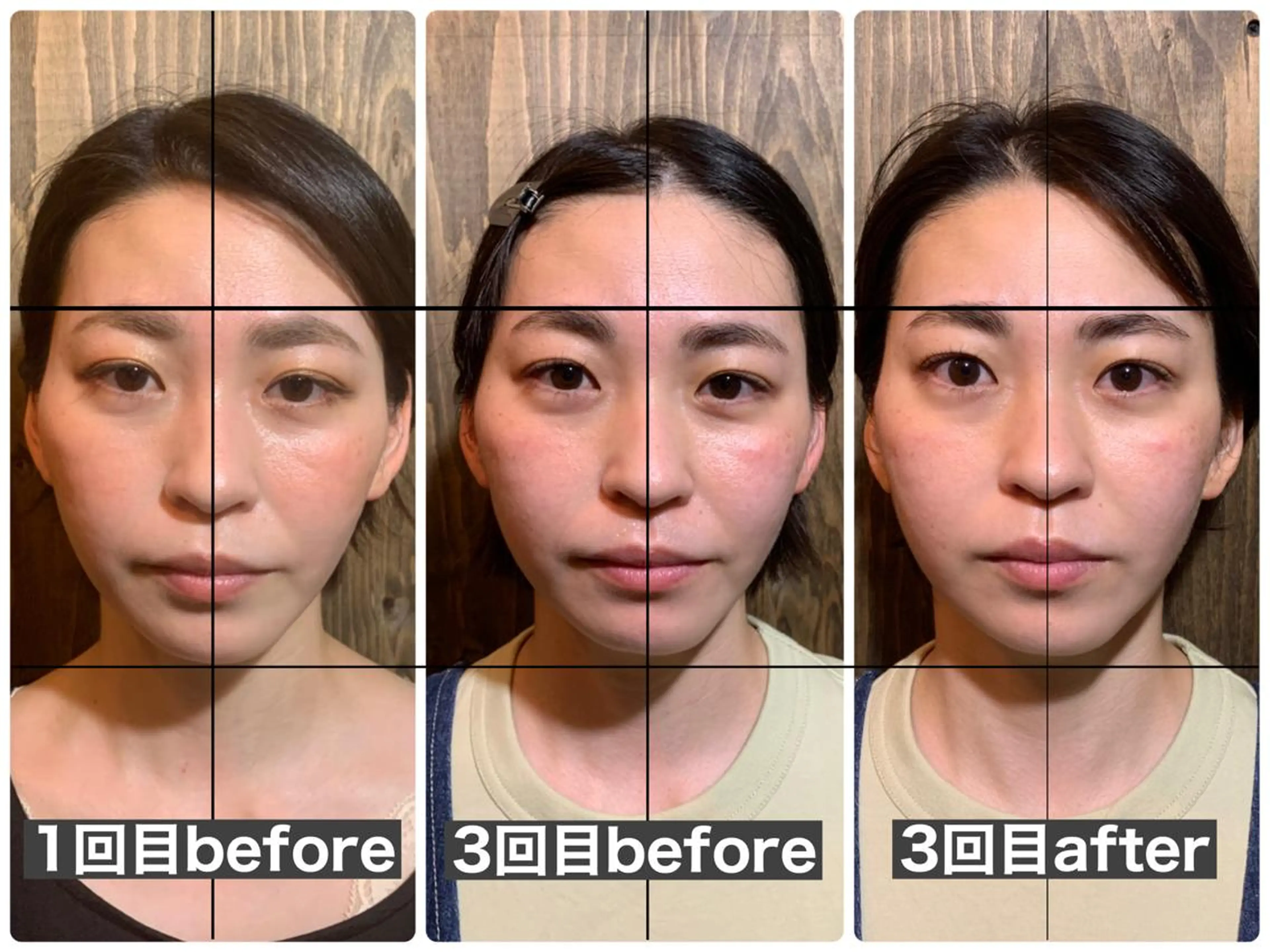 エステ リラク 💎後悔させない小顔 矯正💎イトヤマ🌱のエステ・リラクイメージ