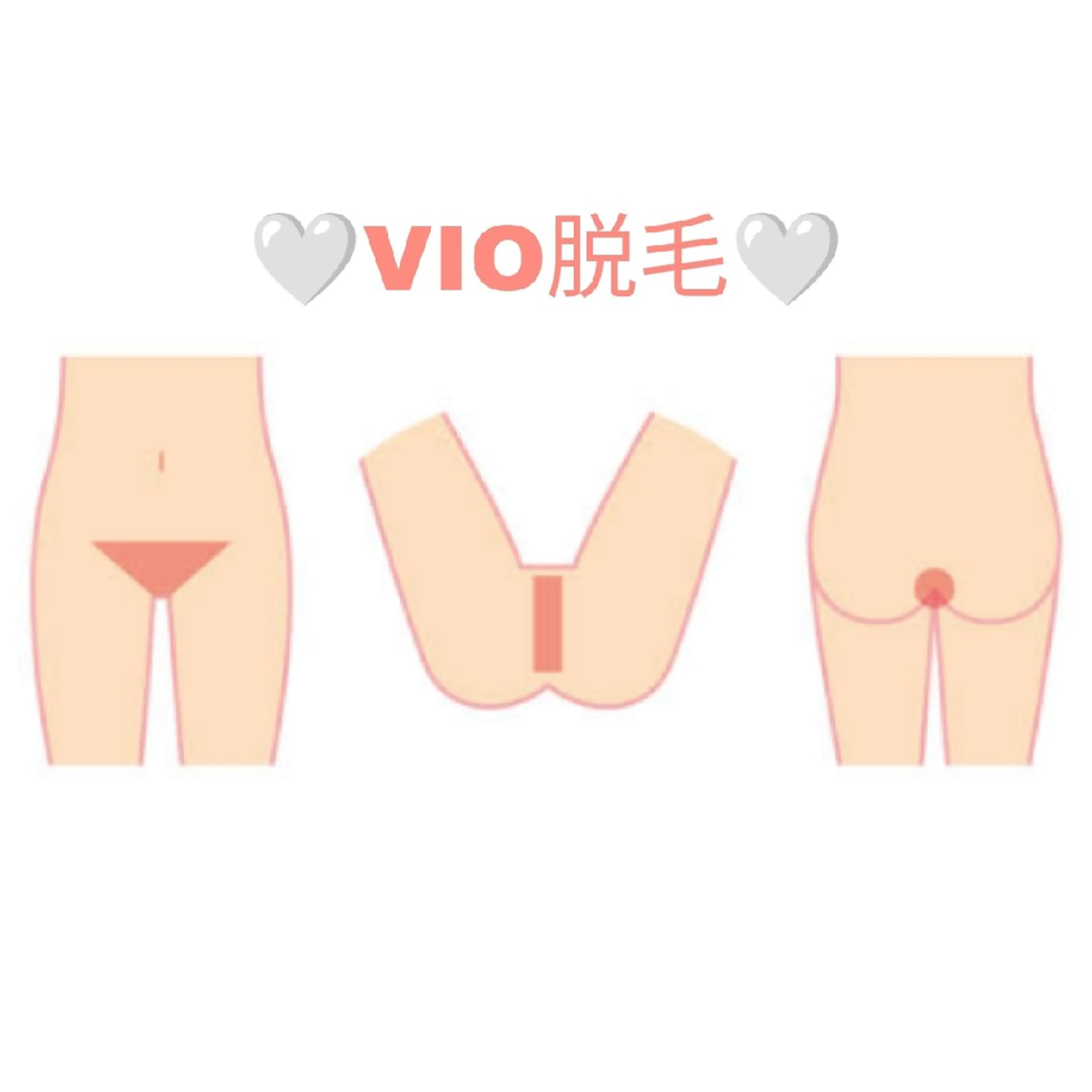 VIO脱毛クーポン🌟シェービングはこちらで🙋🏻‍♀️形も一緒に決められます！初めての方も是非😊へそ下も照射しますの写真
