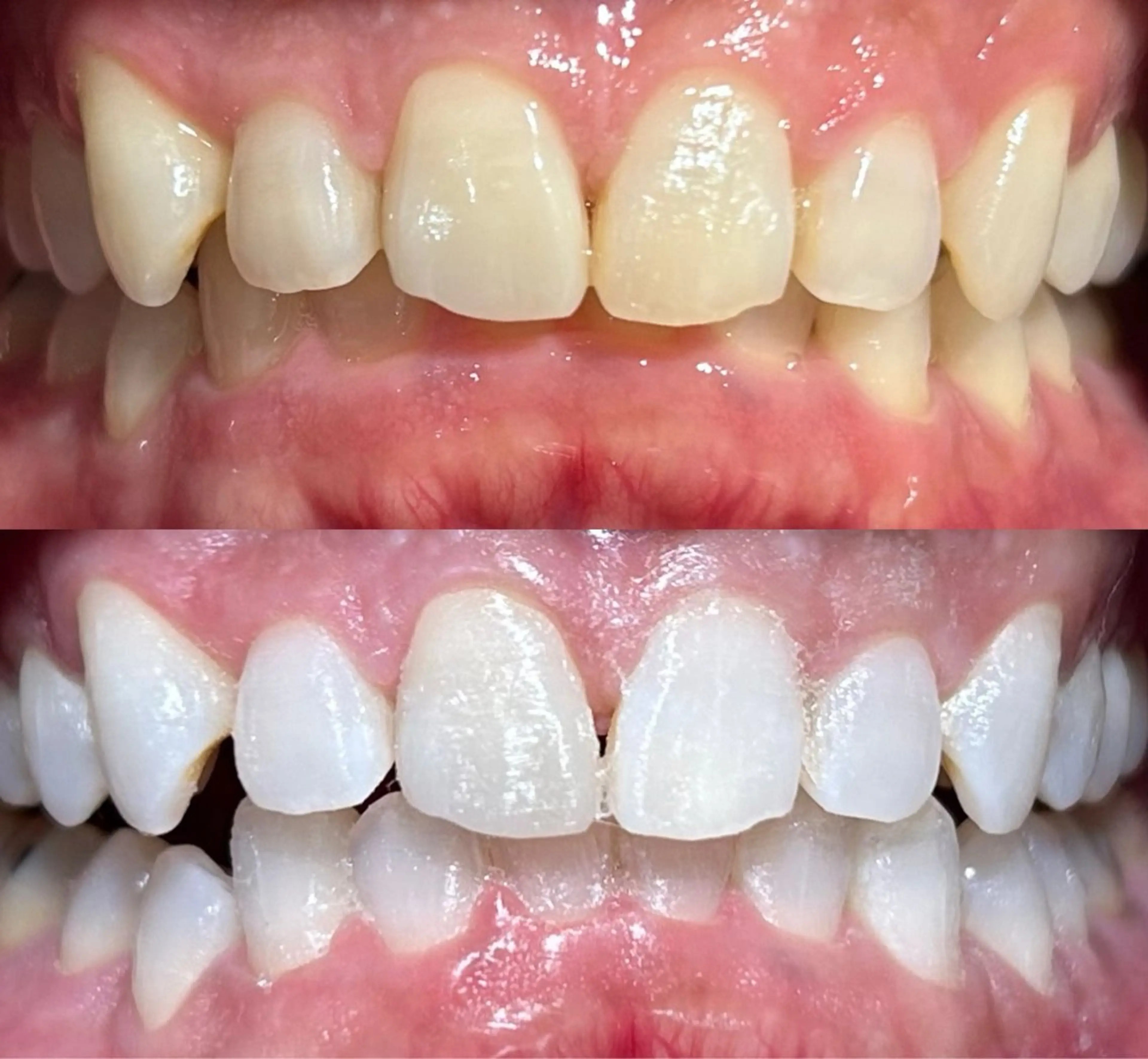 io teeth careのその他イメージ