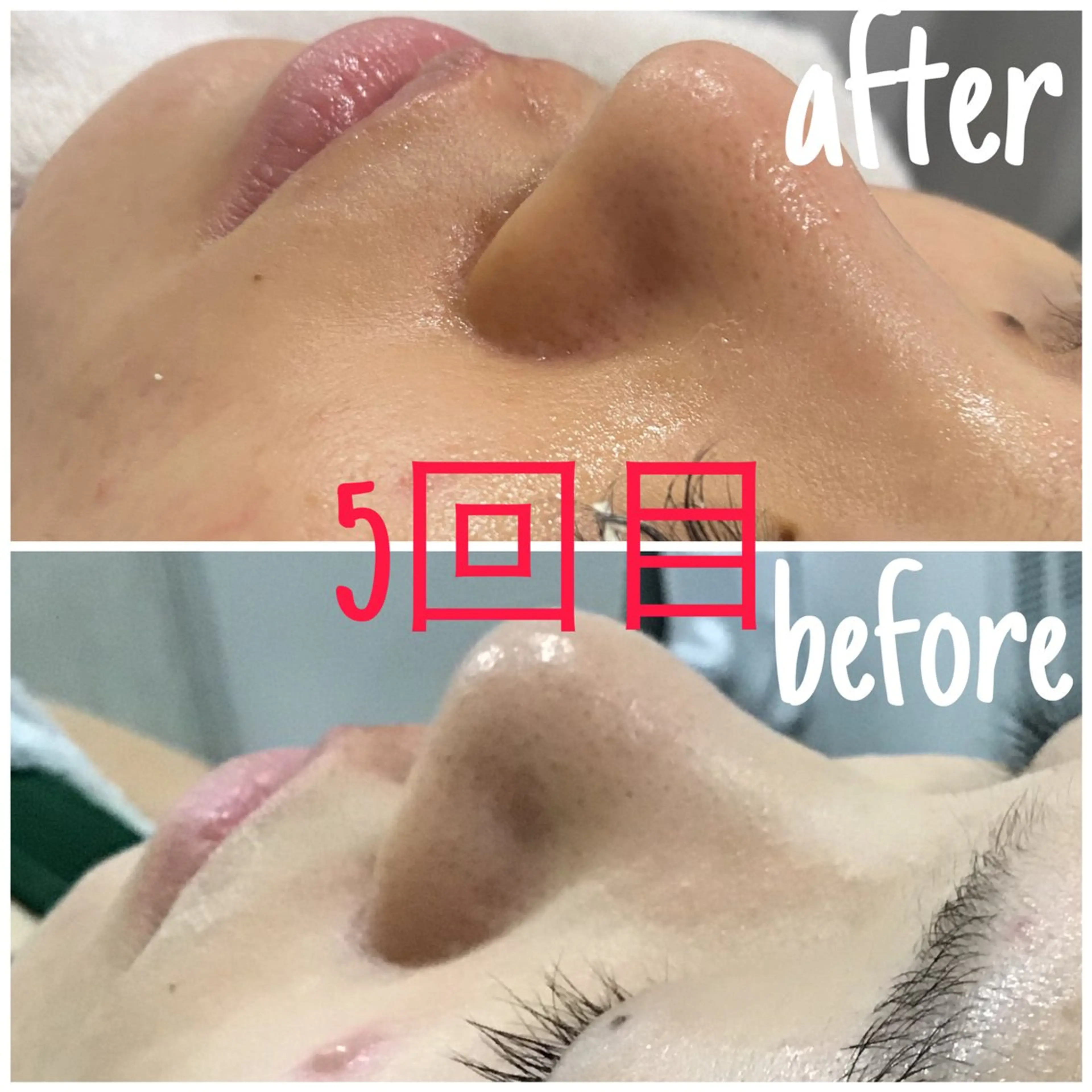 エステ 毛穴洗浄・痩身・脱毛 /アルカンジュのエステ・リラクイメージ