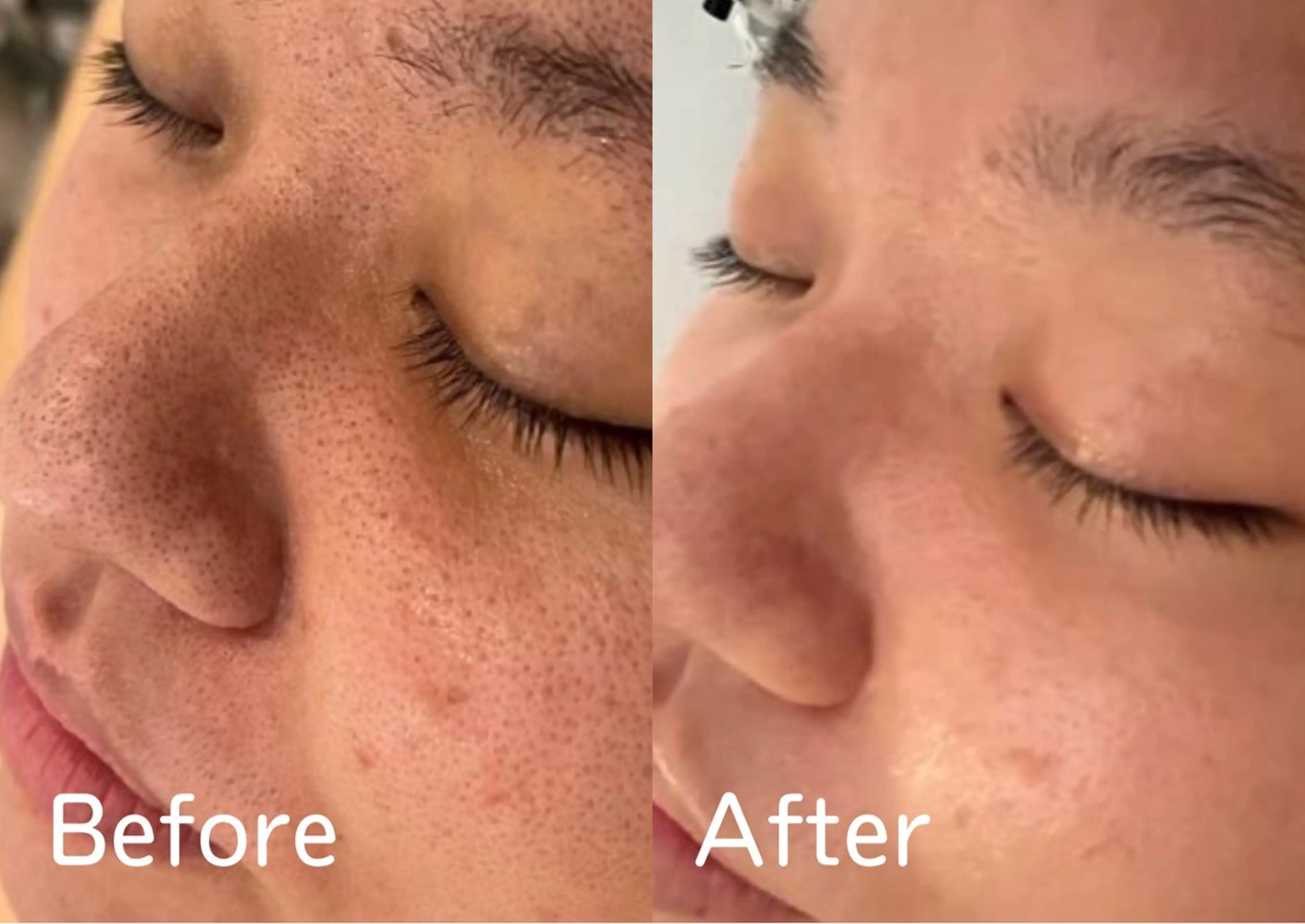 フェイシャル＆痩身 カンフリエ✨七田のその他イメージ