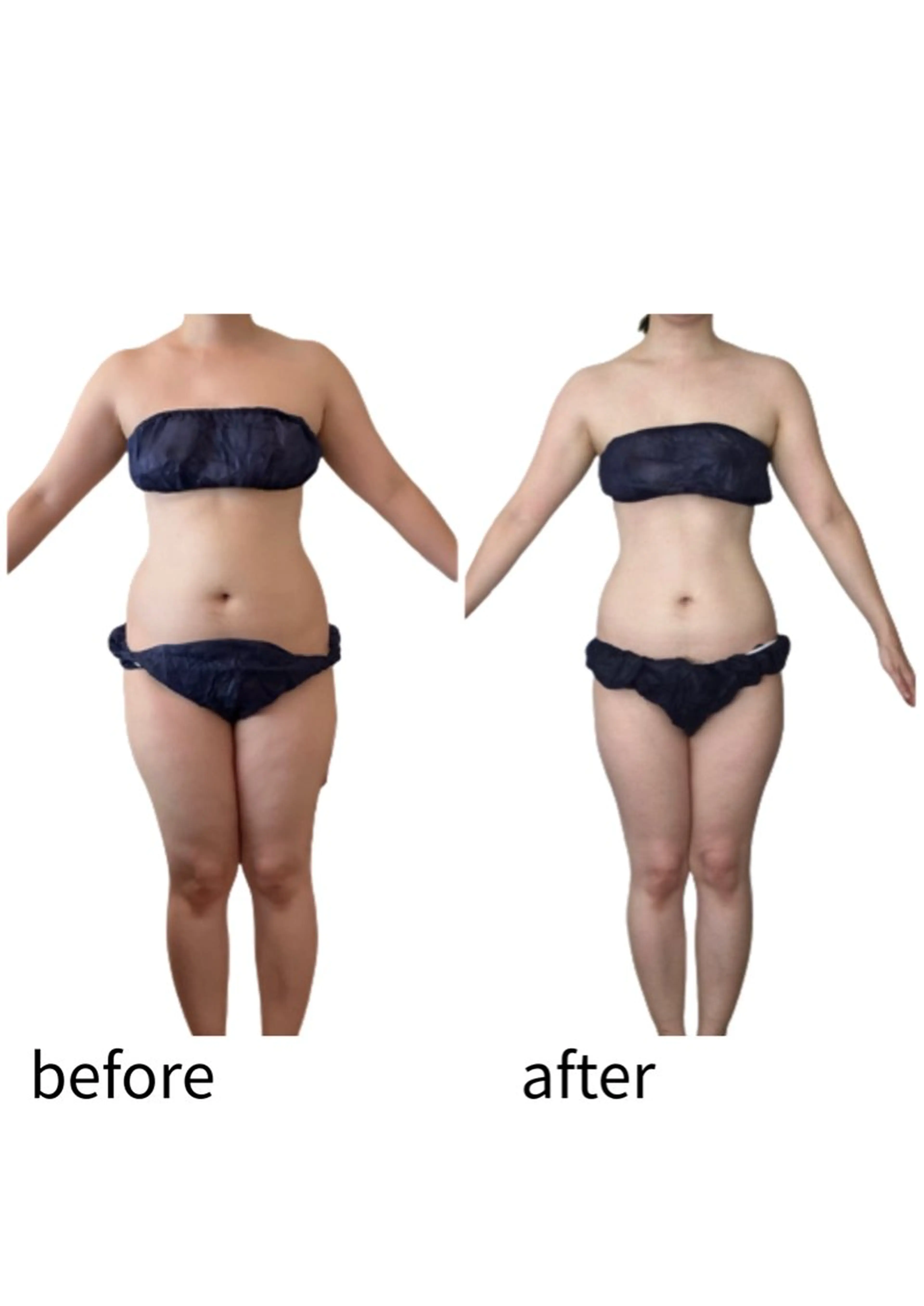 エステ リラク 痩身専門サロン Coralのエステ・リラクイメージ