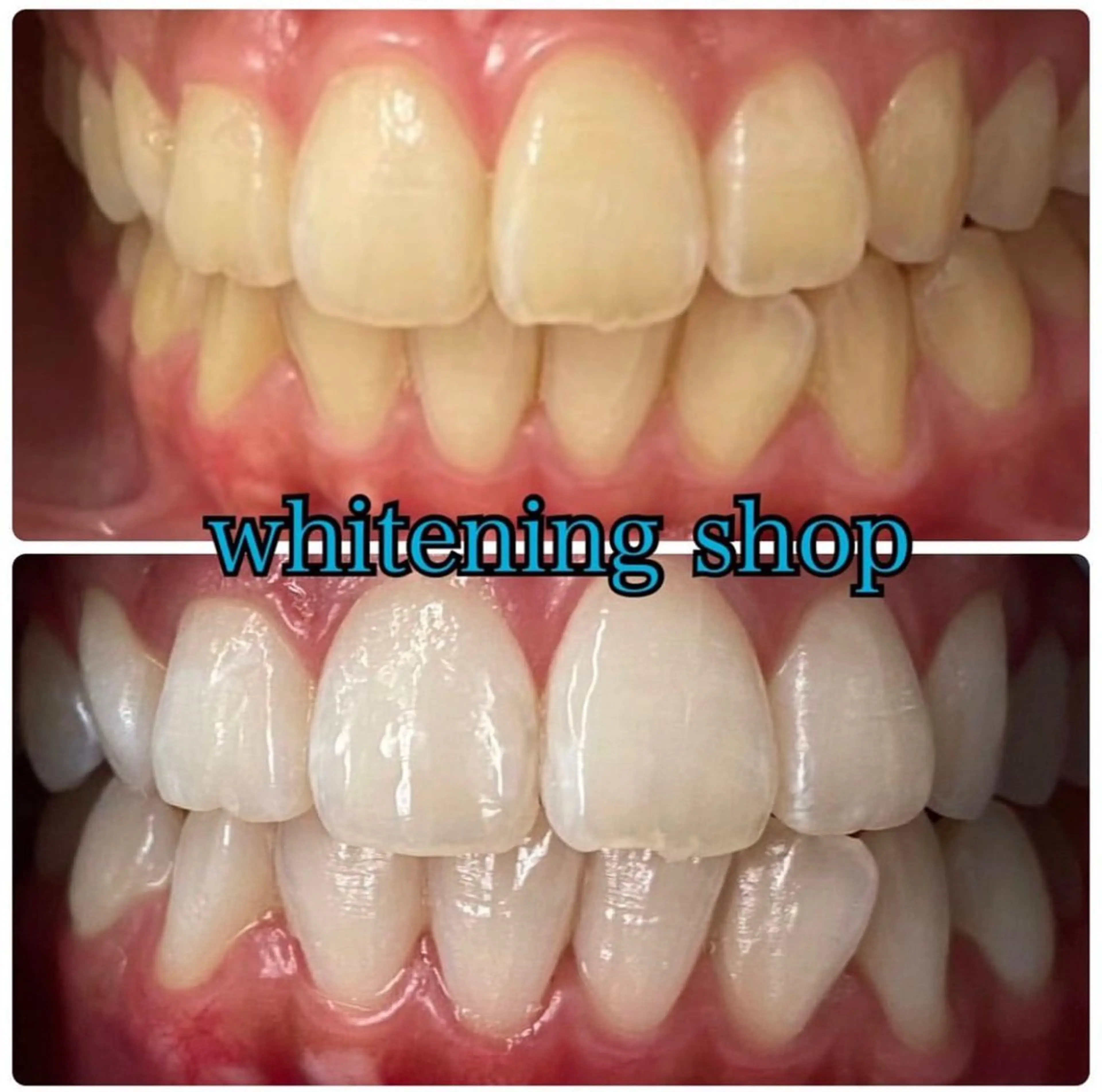 ホワイトニング ショップ吉祥寺店のエステ・リラクイメージ