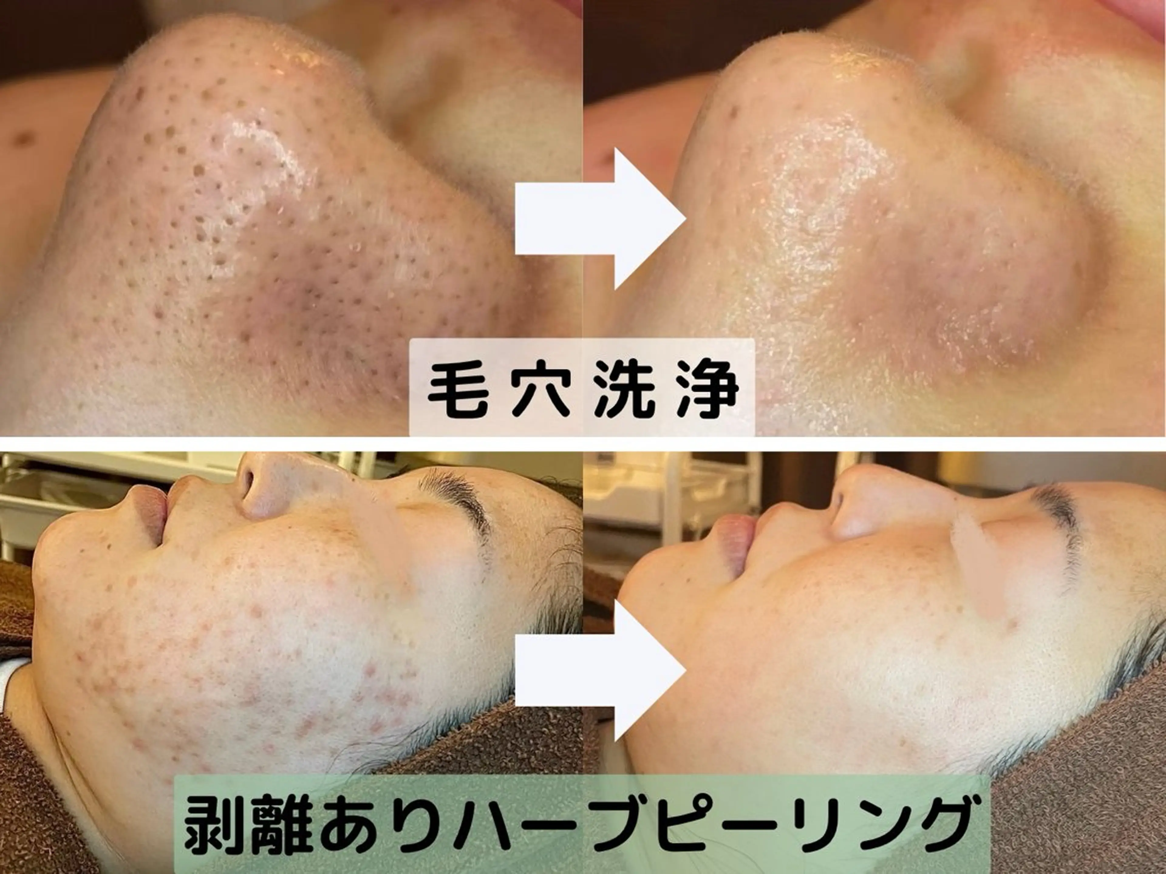 【肌質改善サロン】 医療提携シャルム池袋のエステ・リラクイメージ