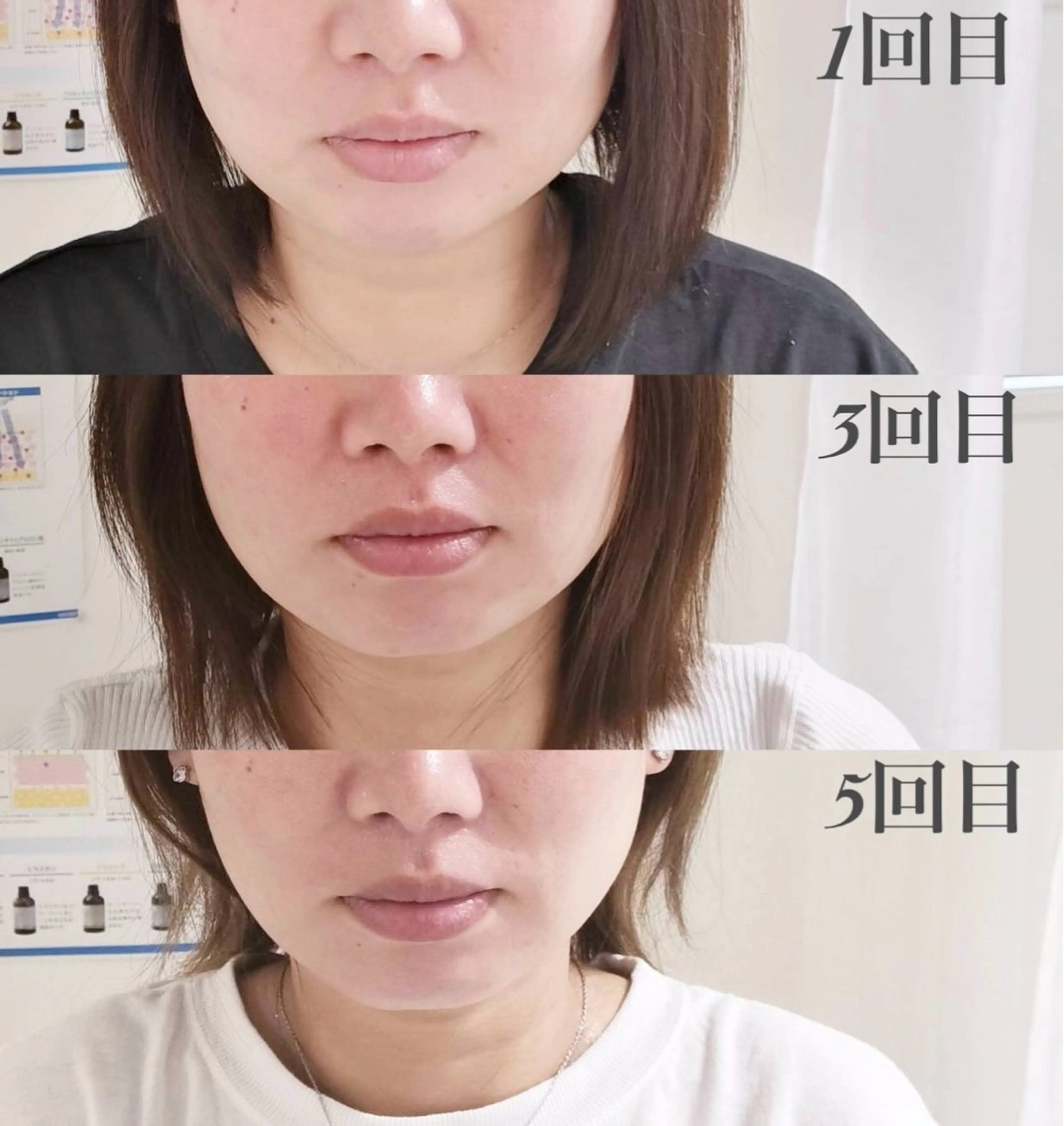 小顔・ツルツル素肌 ハリステリアのエステ・リラクイメージ