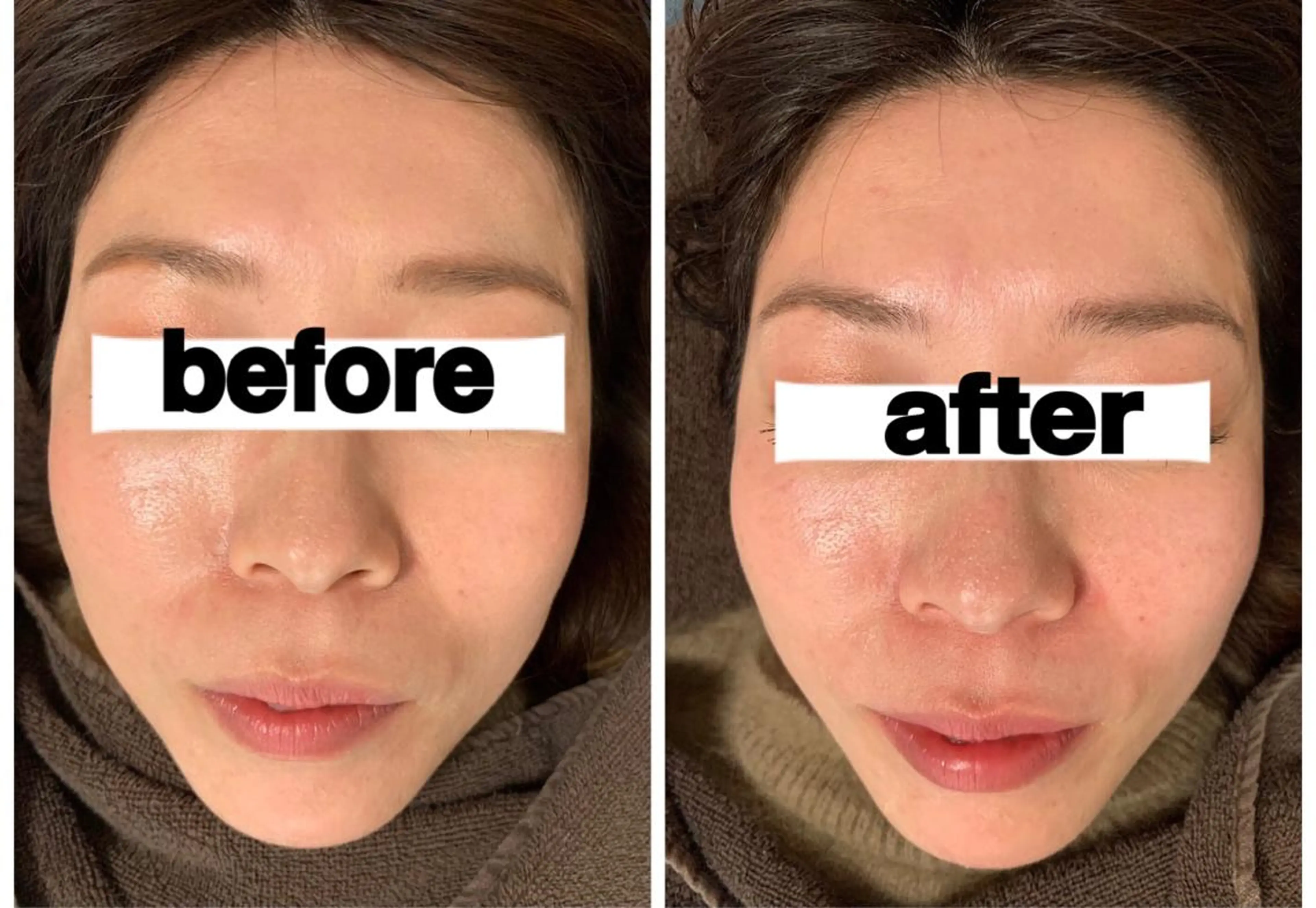 食べながら魅せボディ éclatJua川越のエステ・リラクイメージ