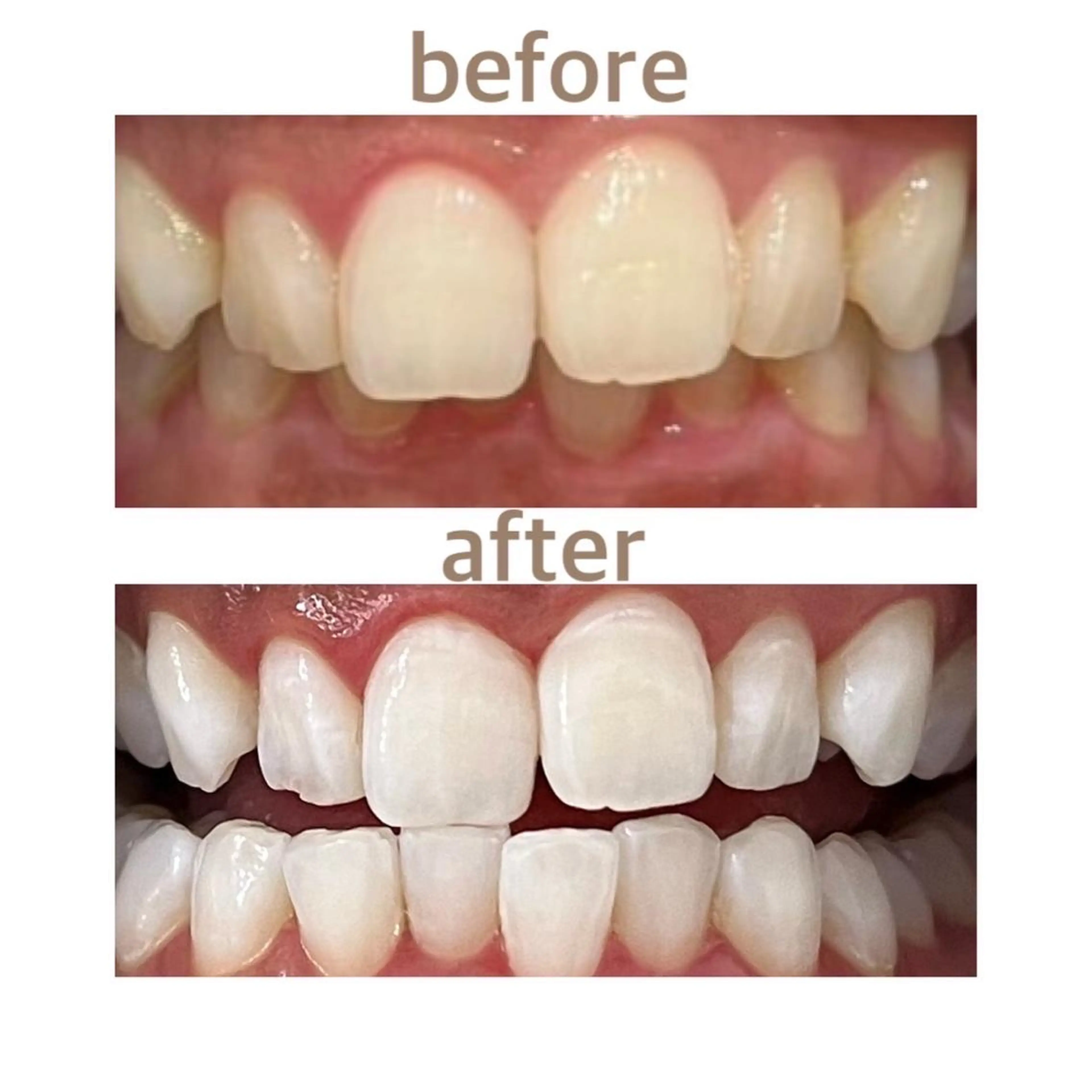 メンズ その他 ホワイトニング ショップ本八幡店のエステ・リラクイメージ