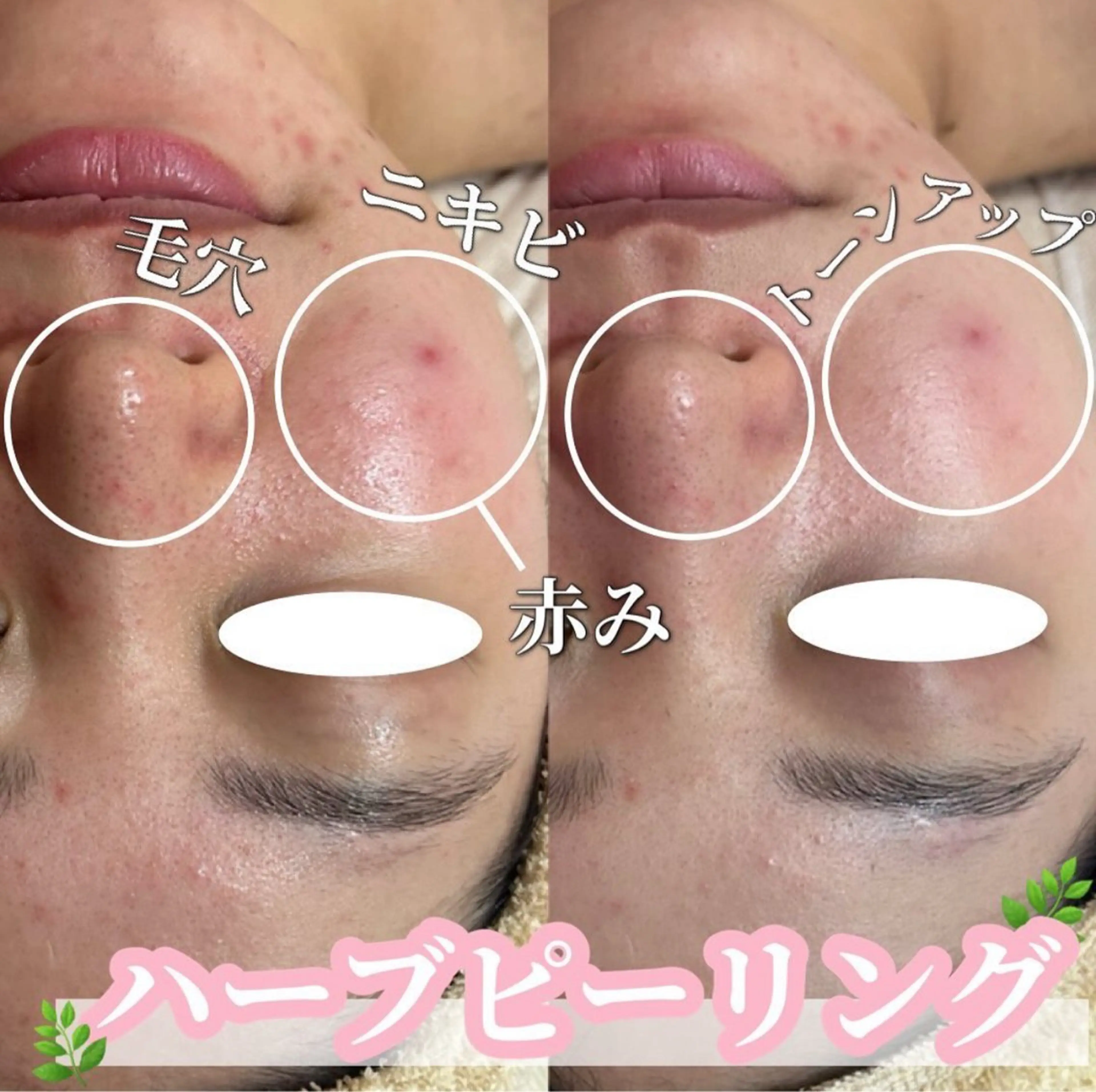 エステ SALON韓国肌管理 東別院のエステ・リラクイメージ