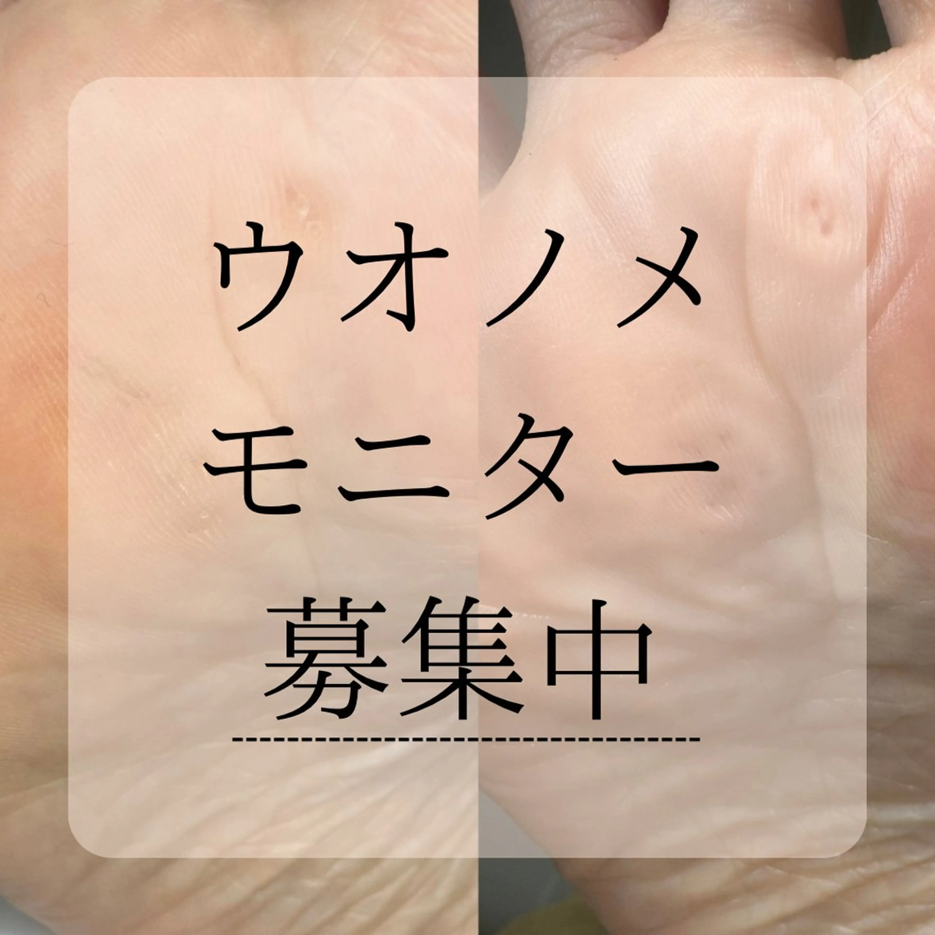 タコ、魚の目にお悩みの方！！何個でも！✨練習、撮影モデル募集！の写真