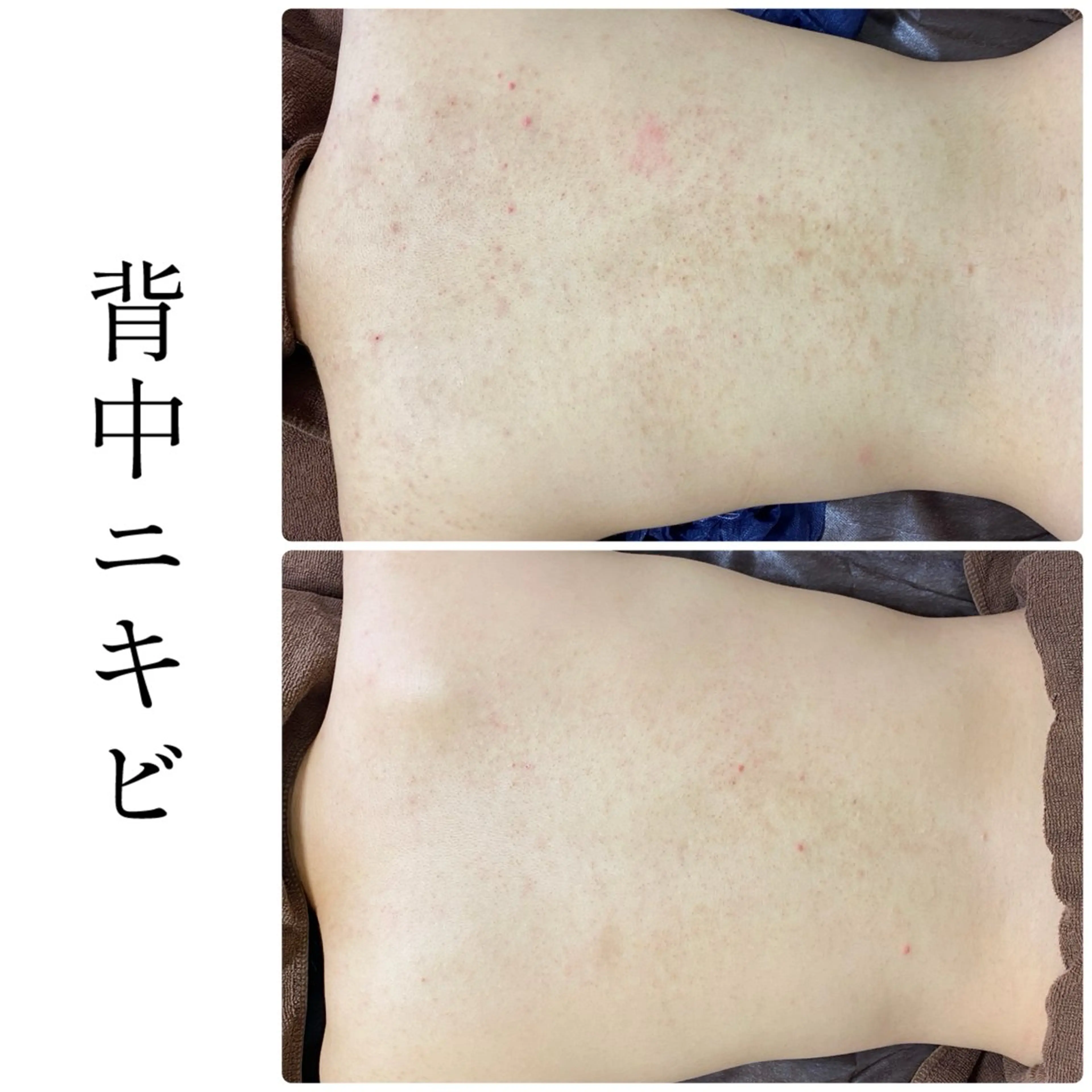 エステ ハーブピーリング専門 BIOEL横浜のエステ・リラクイメージ