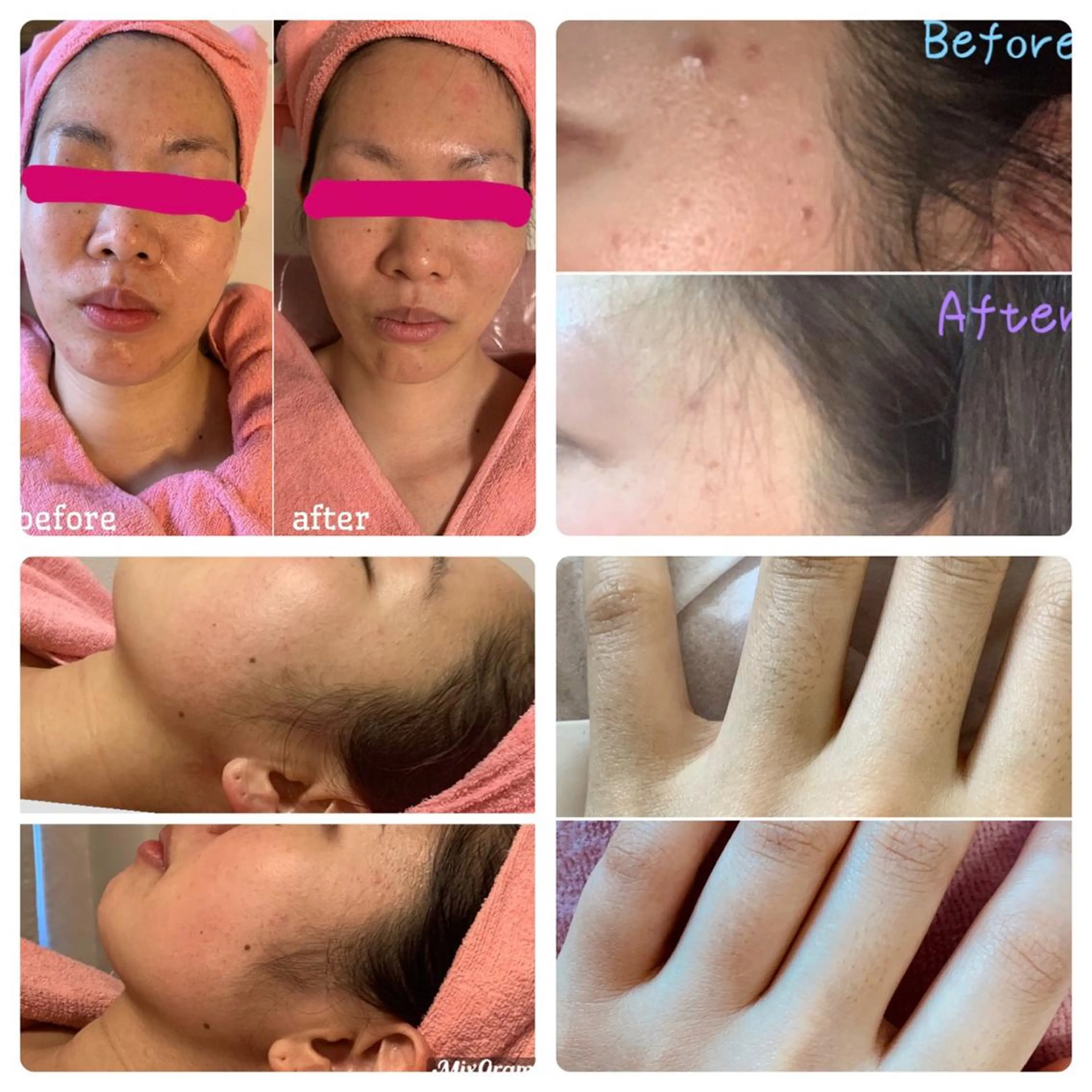 Linomalie エステ/たるみ/脱毛のエステ・リラクイメージ