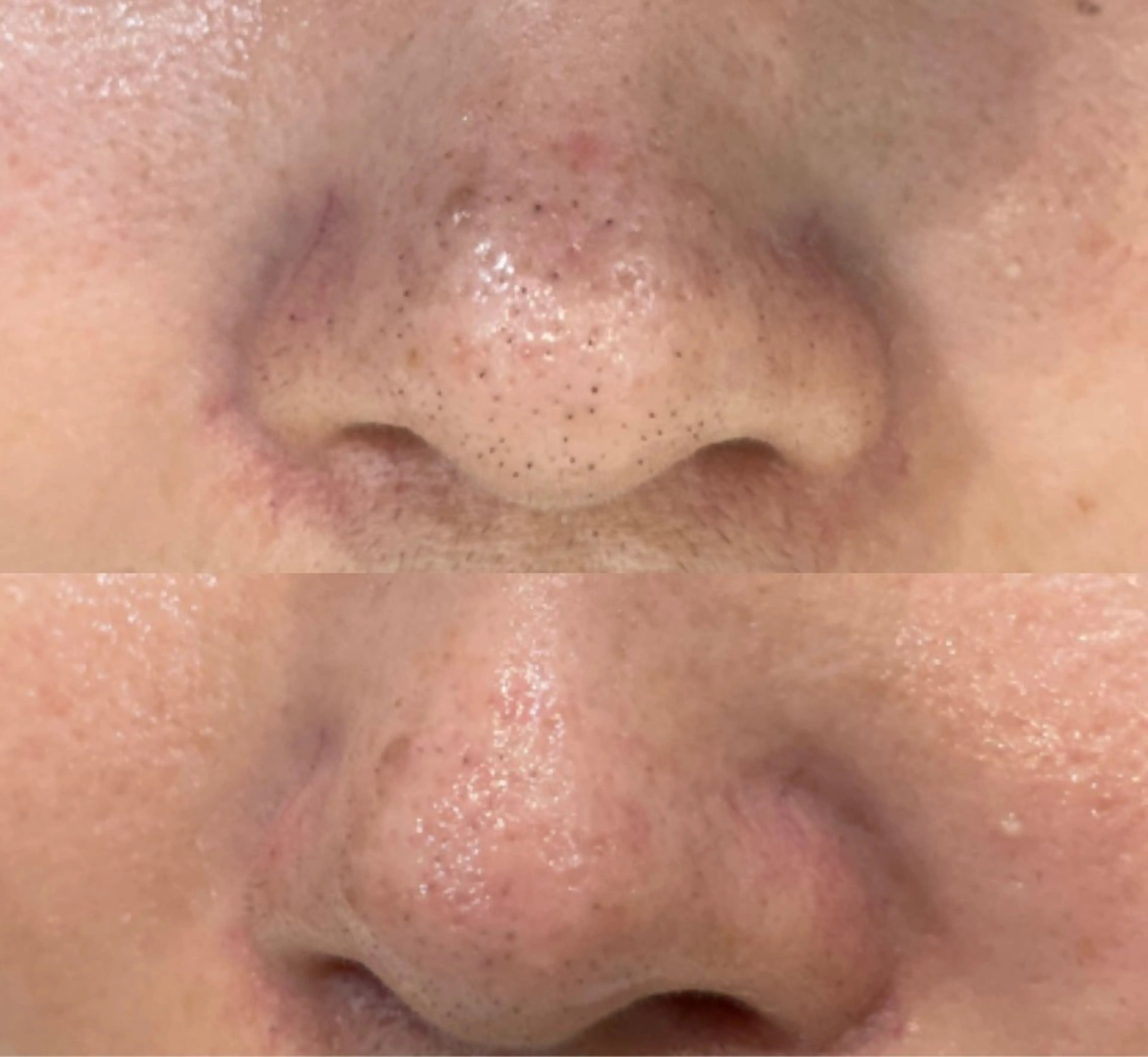 DeI'm   名古屋栄所属・小林 玲菜のエステ・リラクイメージ