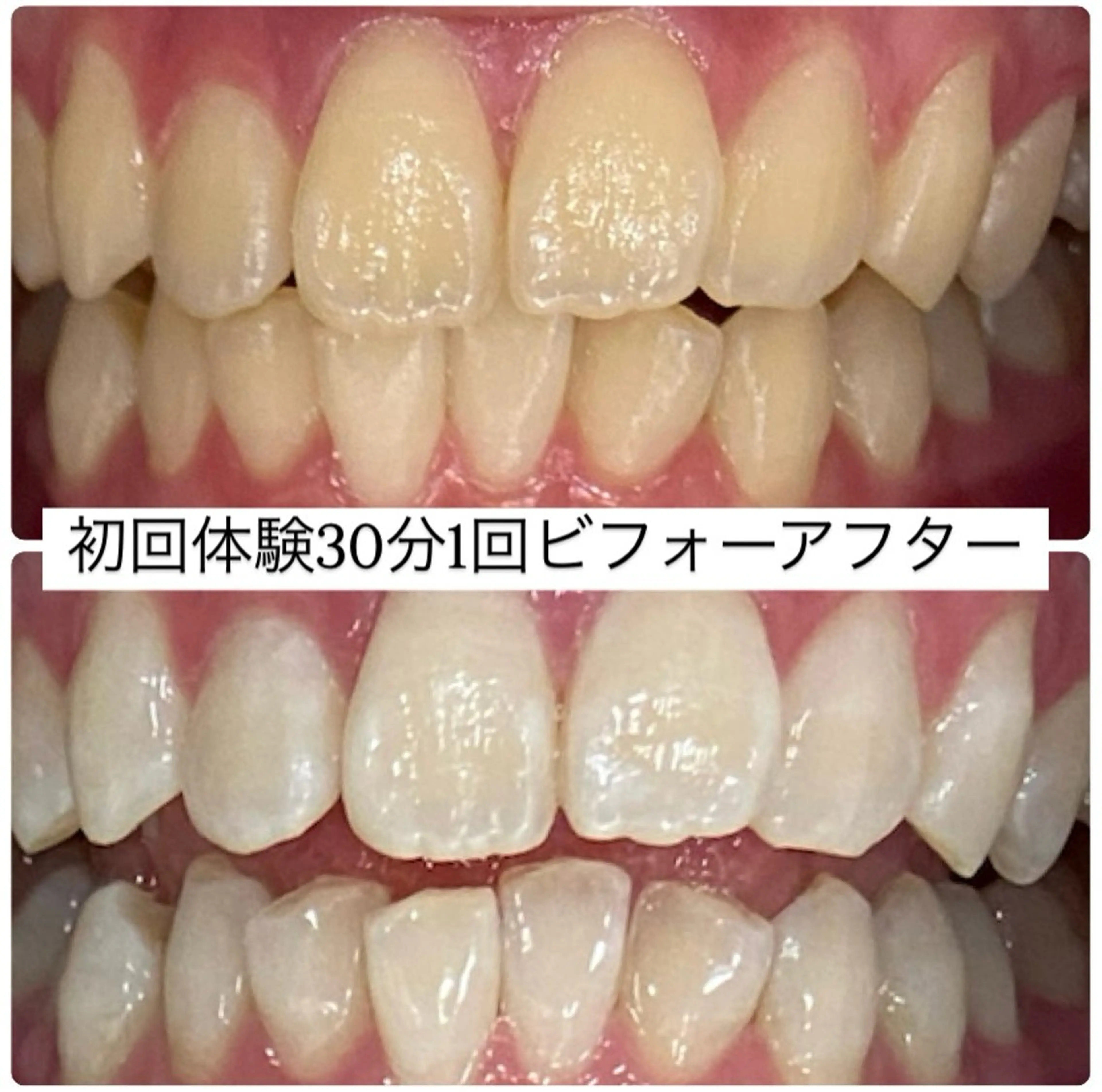 PLATINUM Beauty 横浜店所属・ホワイトニングルーム 横浜店のその他イメージ