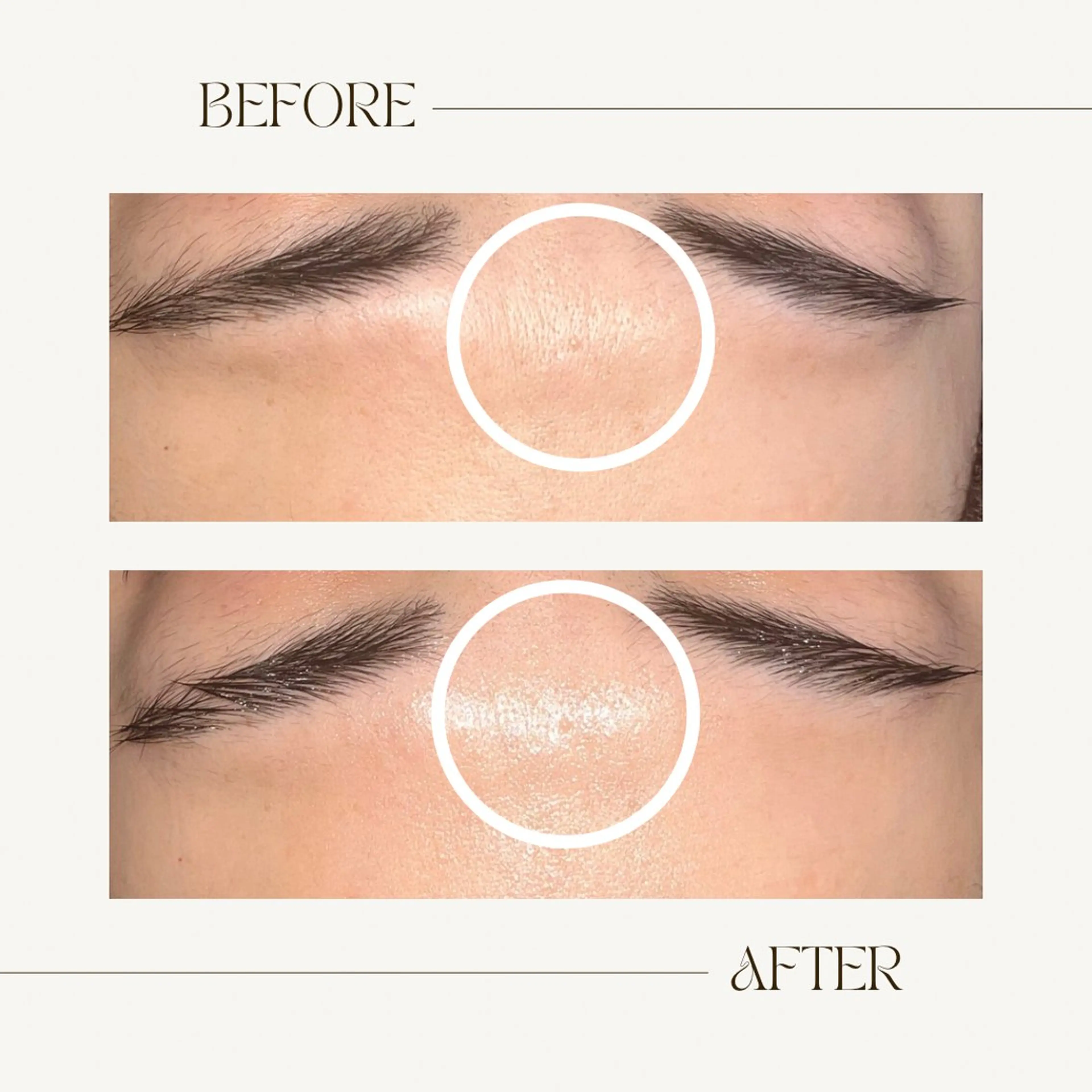 エステ 1st｜フェイシャル エステ専門店のエステ・リラクイメージ