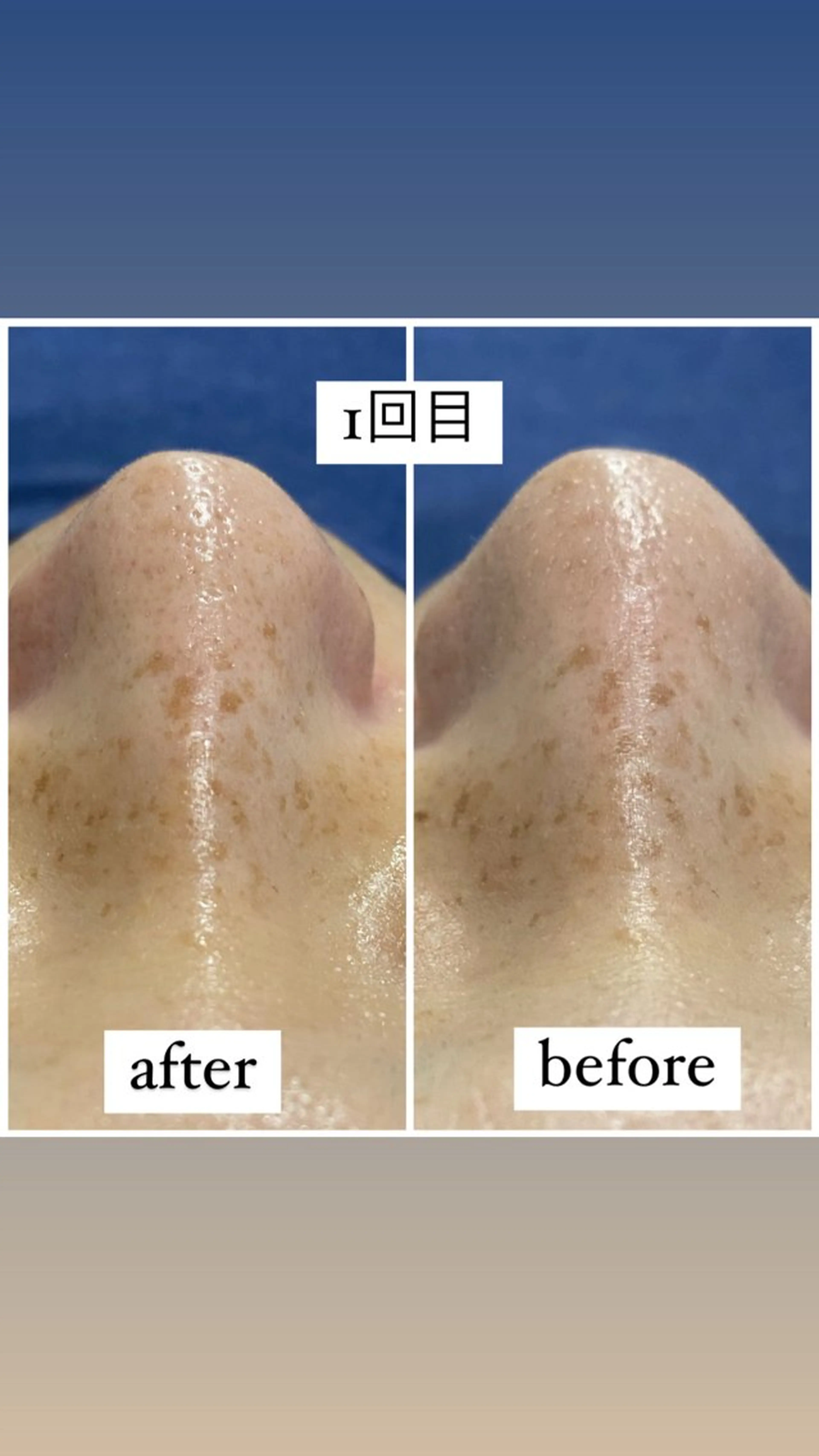 痩身/毛穴洗浄/脱毛 アルカンジュのエステ・リラクイメージ