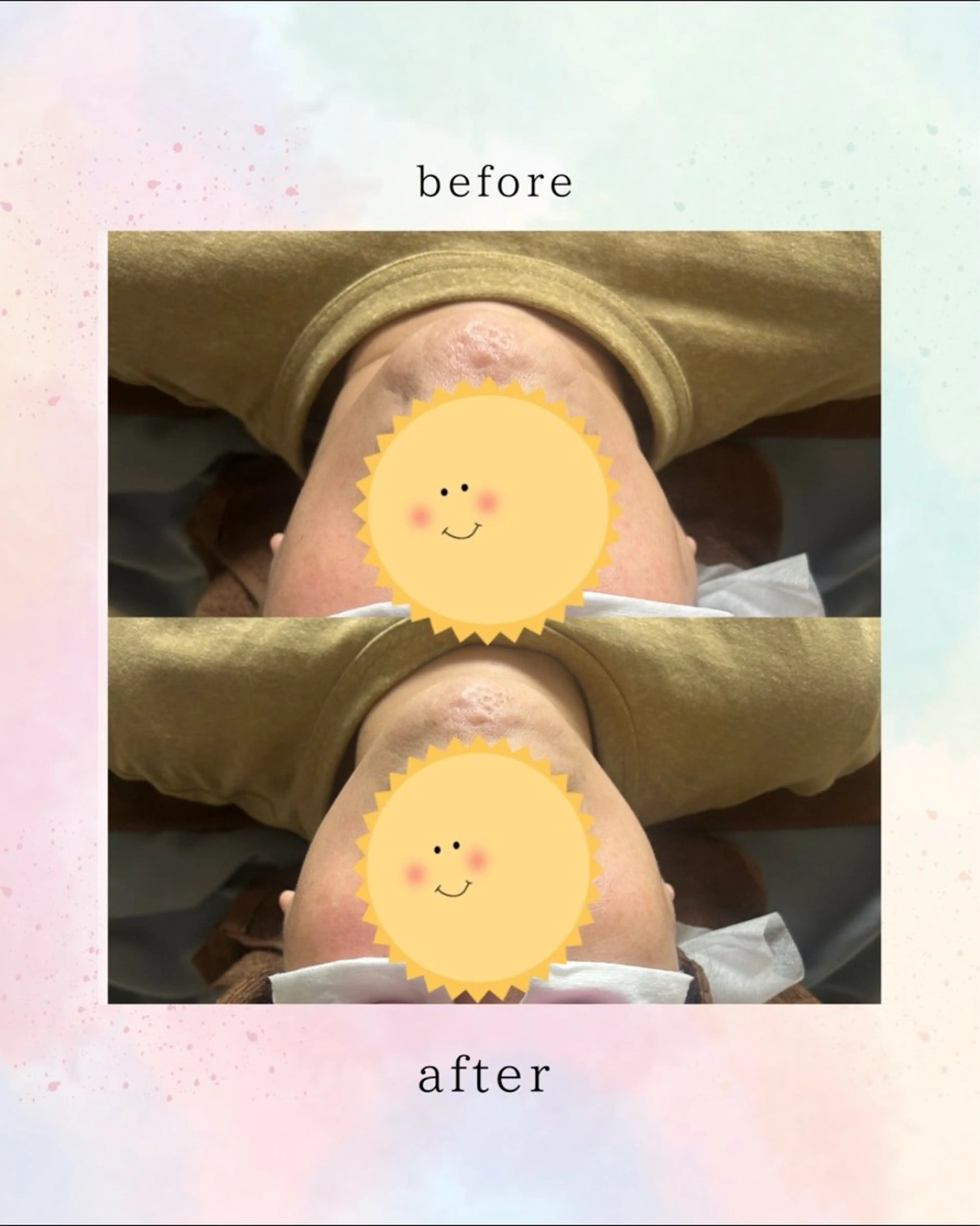 エステ Belle ＋vi（ベル）のその他イメージ