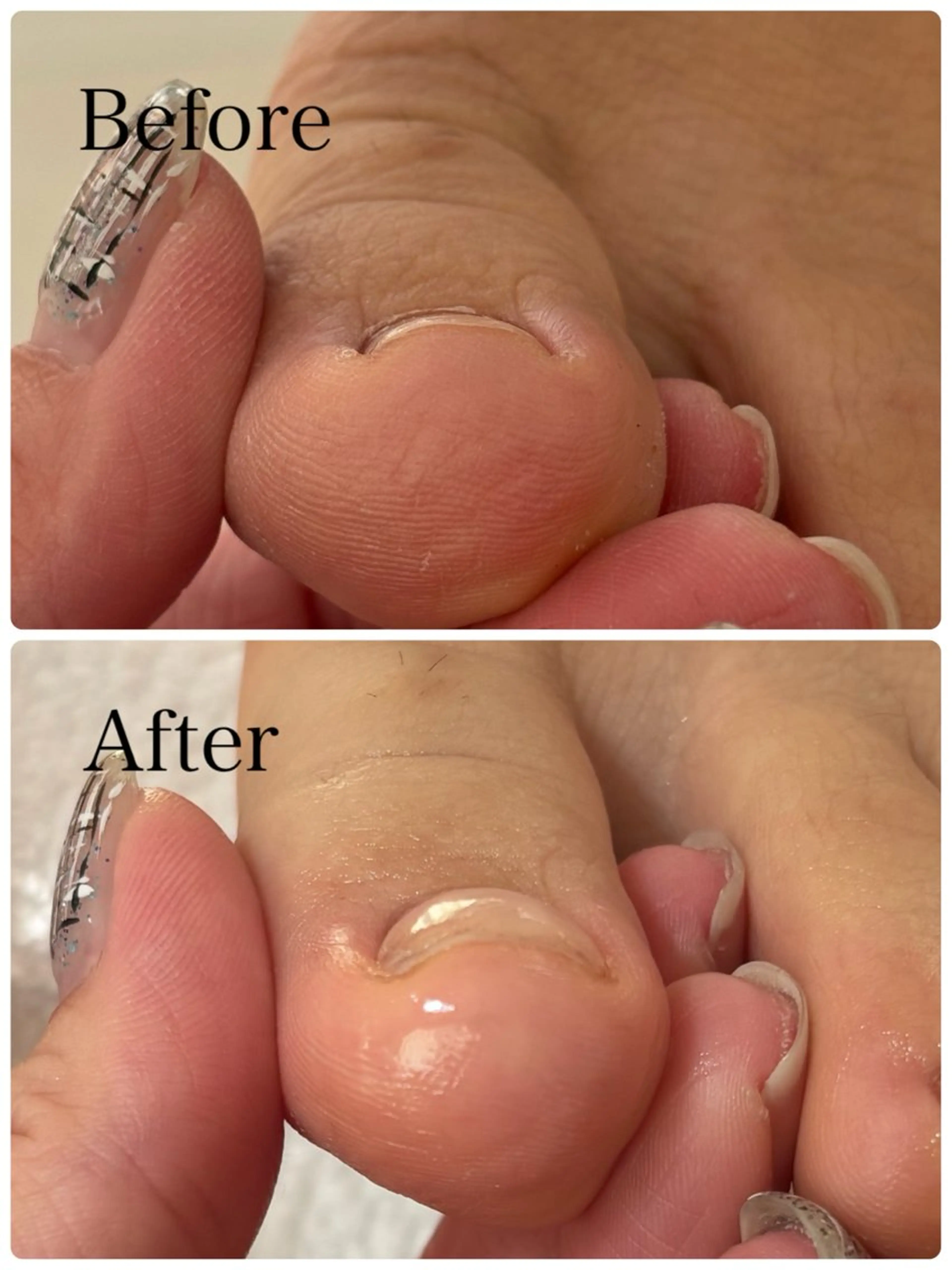 ネイル Alo.nail アロ•ネイルのネイルデザイン