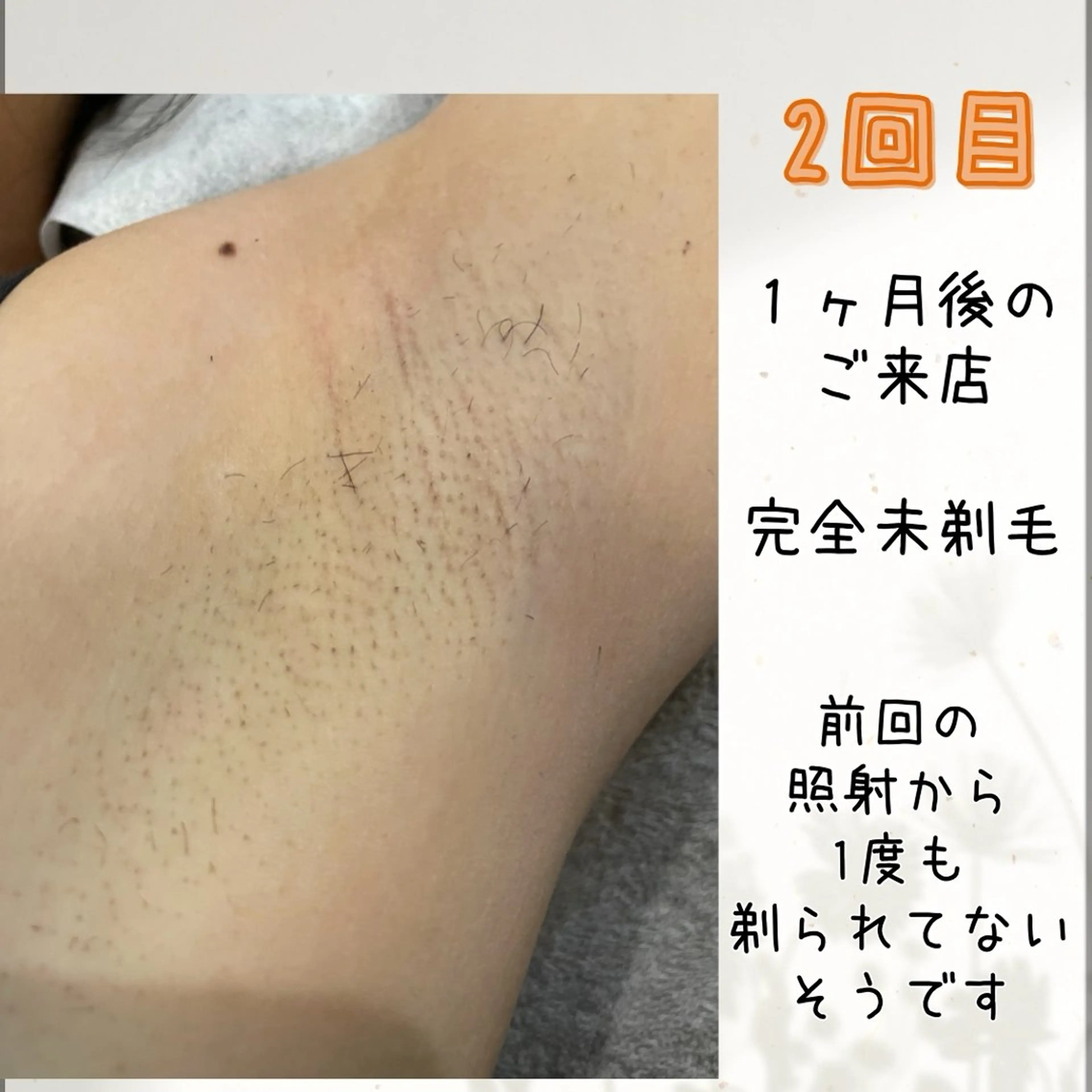 脱毛 脱毛＆リラク FIS福岡薬院店のエステ・リラクイメージ