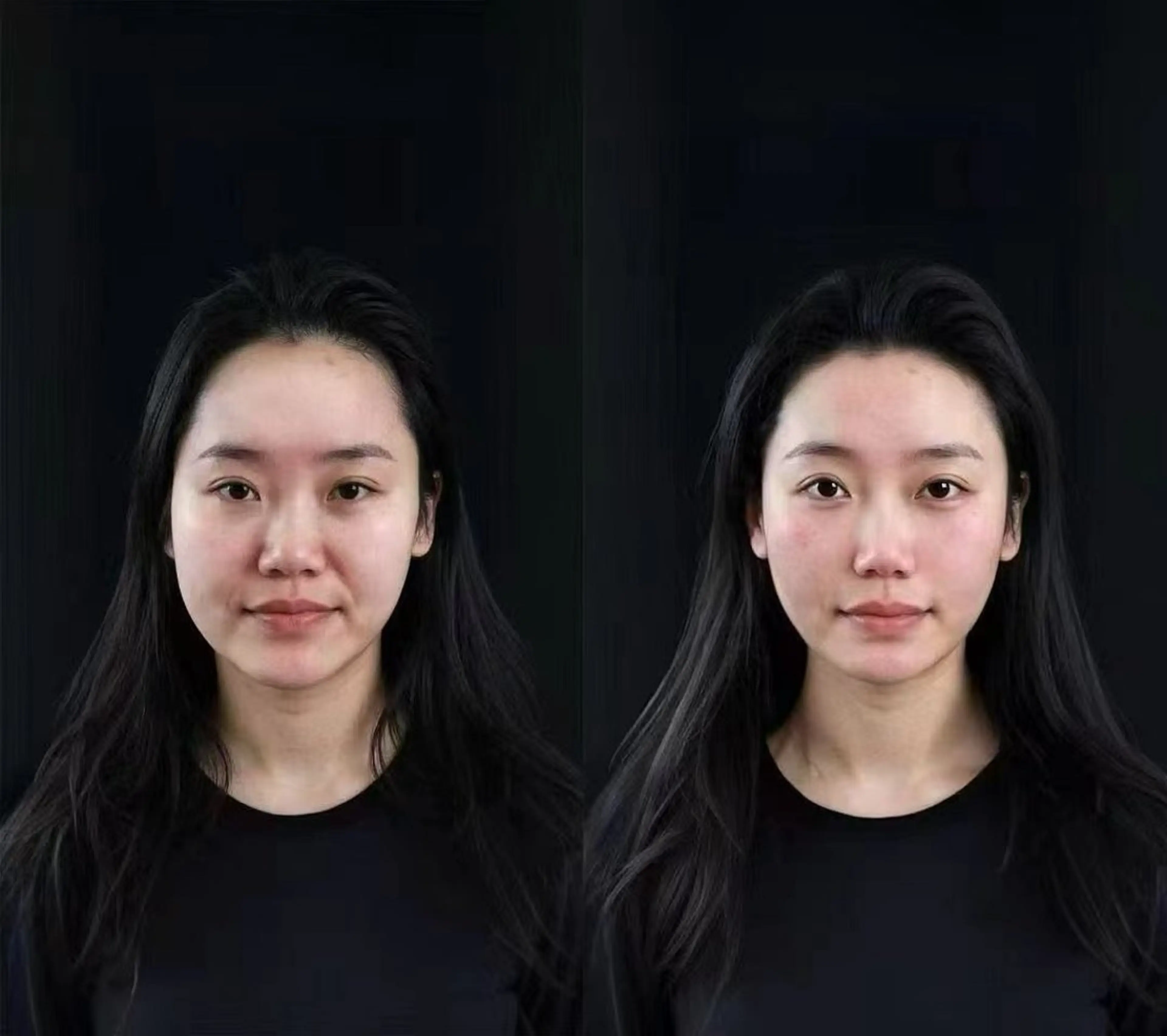 ショート エステ aliaハイフ&水光ジェットサロン所属・aliaハーブ水光店 エステティシャン募集のエステ・リラクイメージ