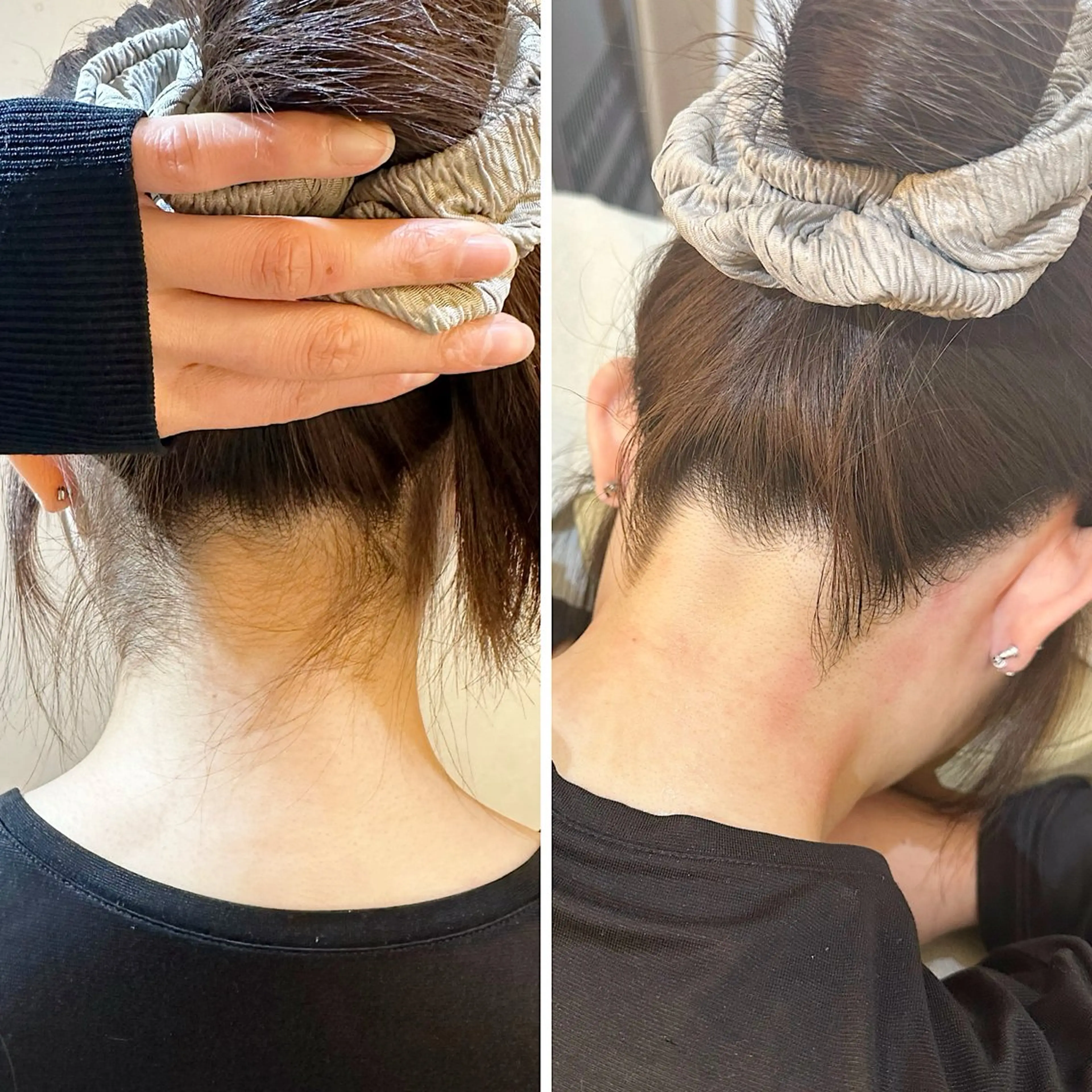 脱毛 うなじ脱毛/美肌脱毛 LABELのエステ・リラクイメージ