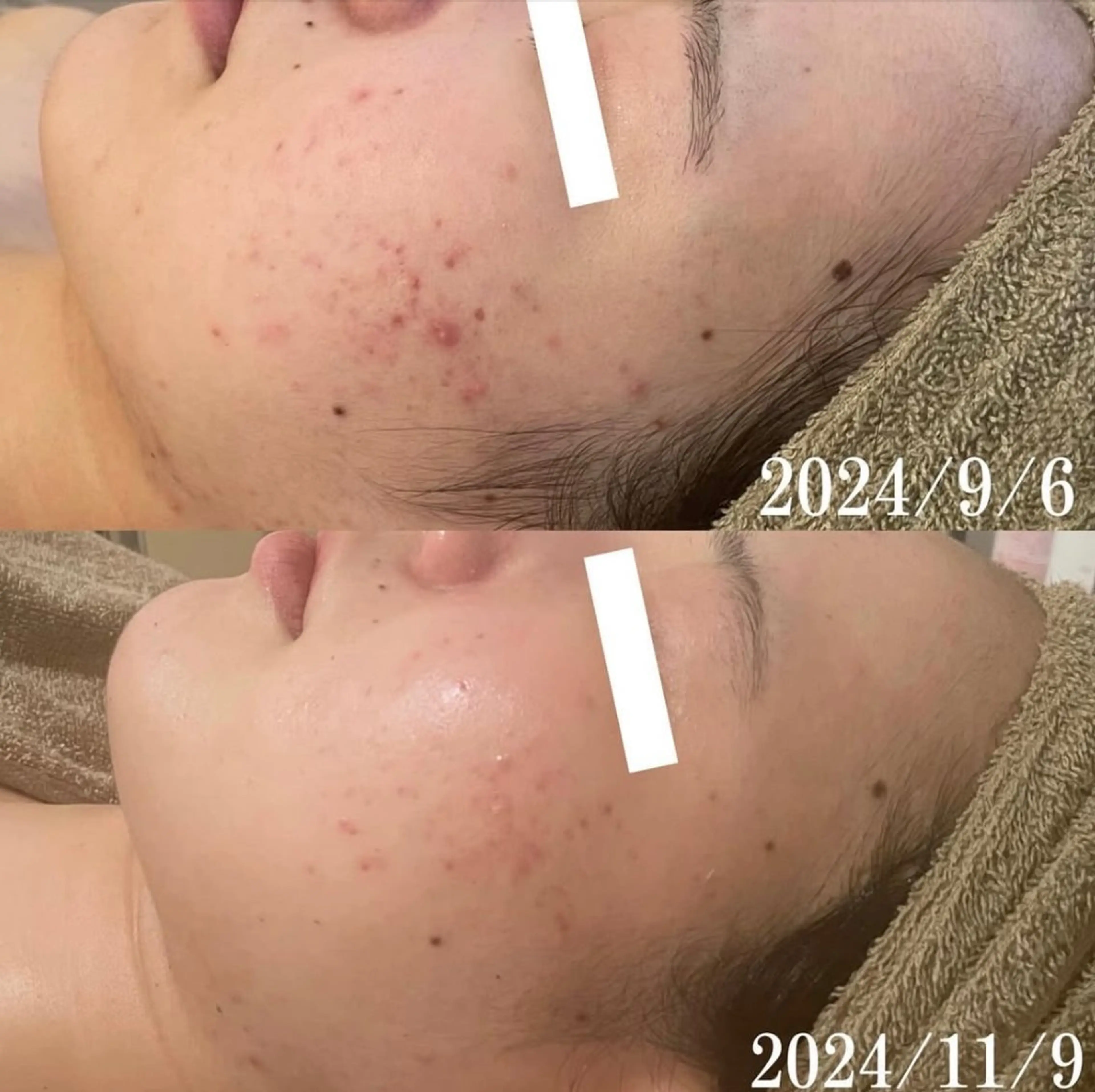 中目黒ハーブピーリン グ🌿ララピールのエステ・リラクイメージ