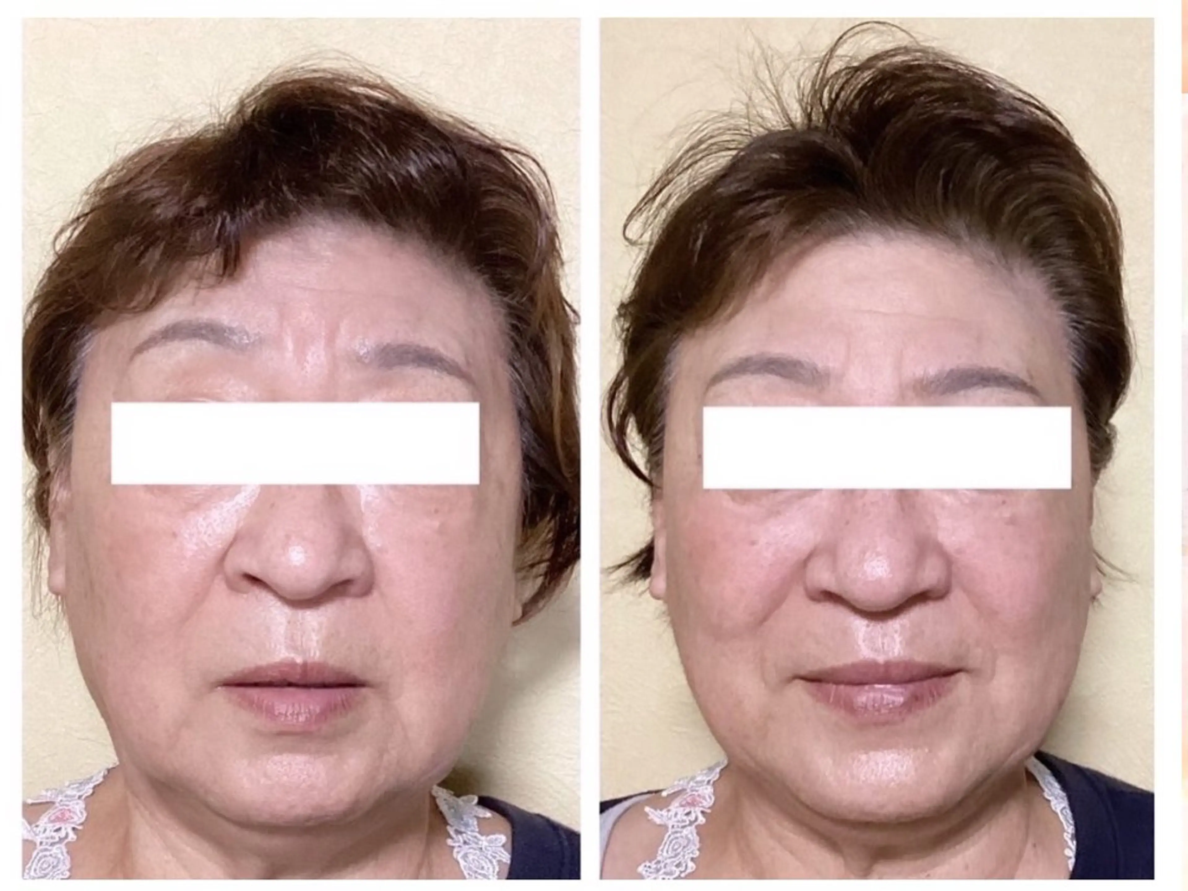 エステ リラク ルコナビューティ所属・小顔・歪み専門 井元 朋子のエステ・リラクイメージ