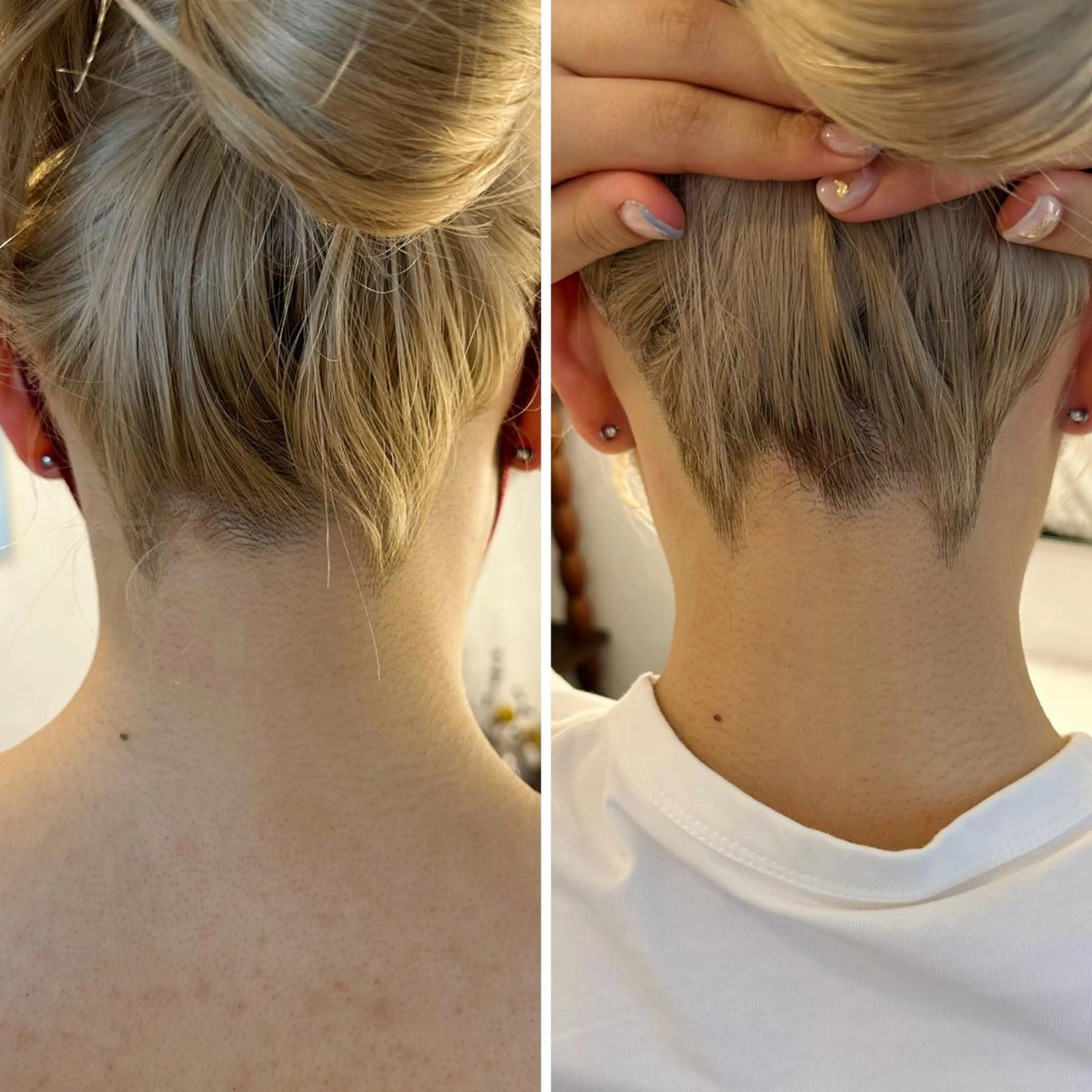 うなじ脱毛/美肌脱毛 LABELのエステ・リラクイメージ