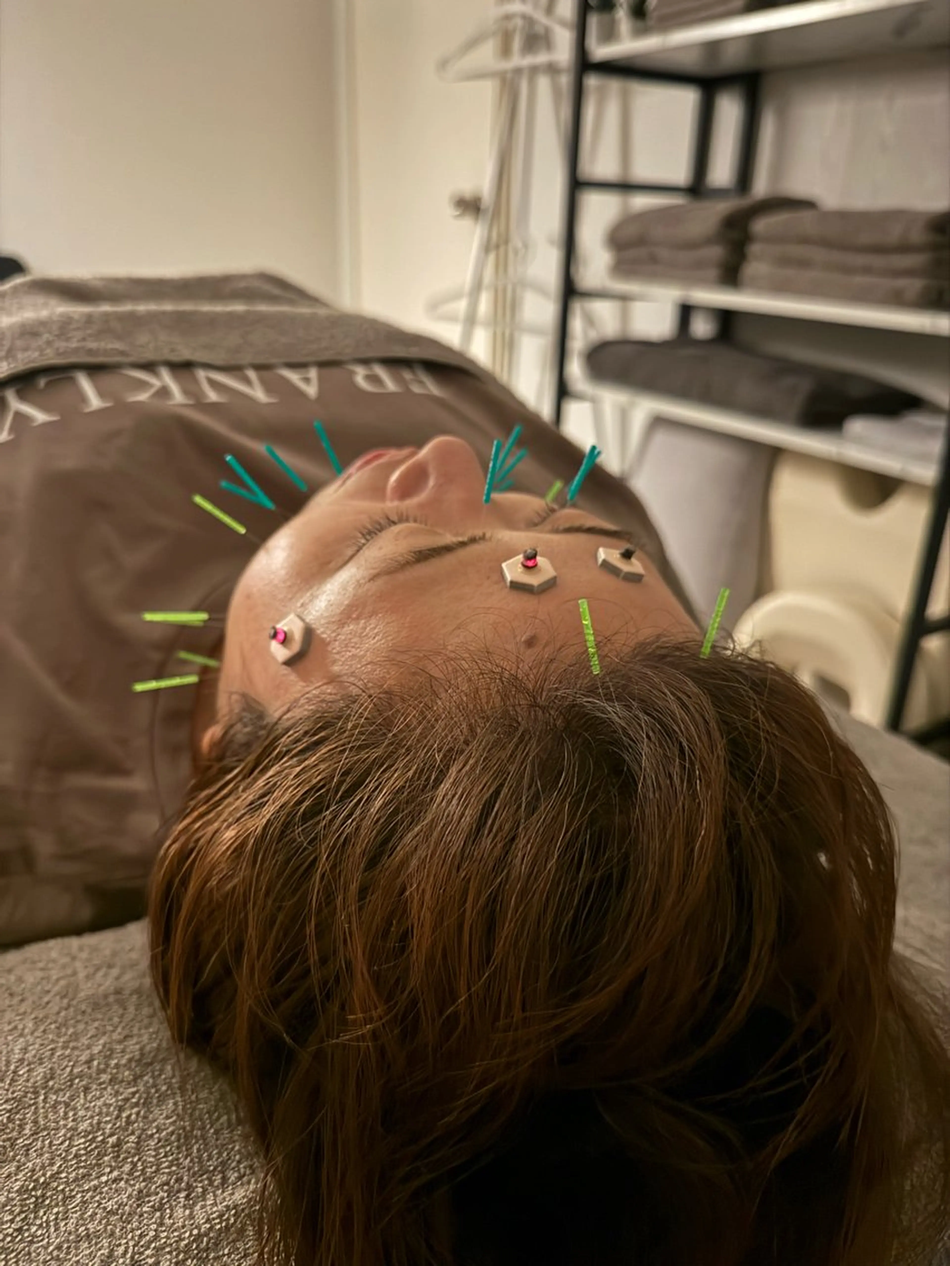 エステ 美容鍼×小顔矯正 ×美容整体　浜川泰仁のエステ・リラクイメージ